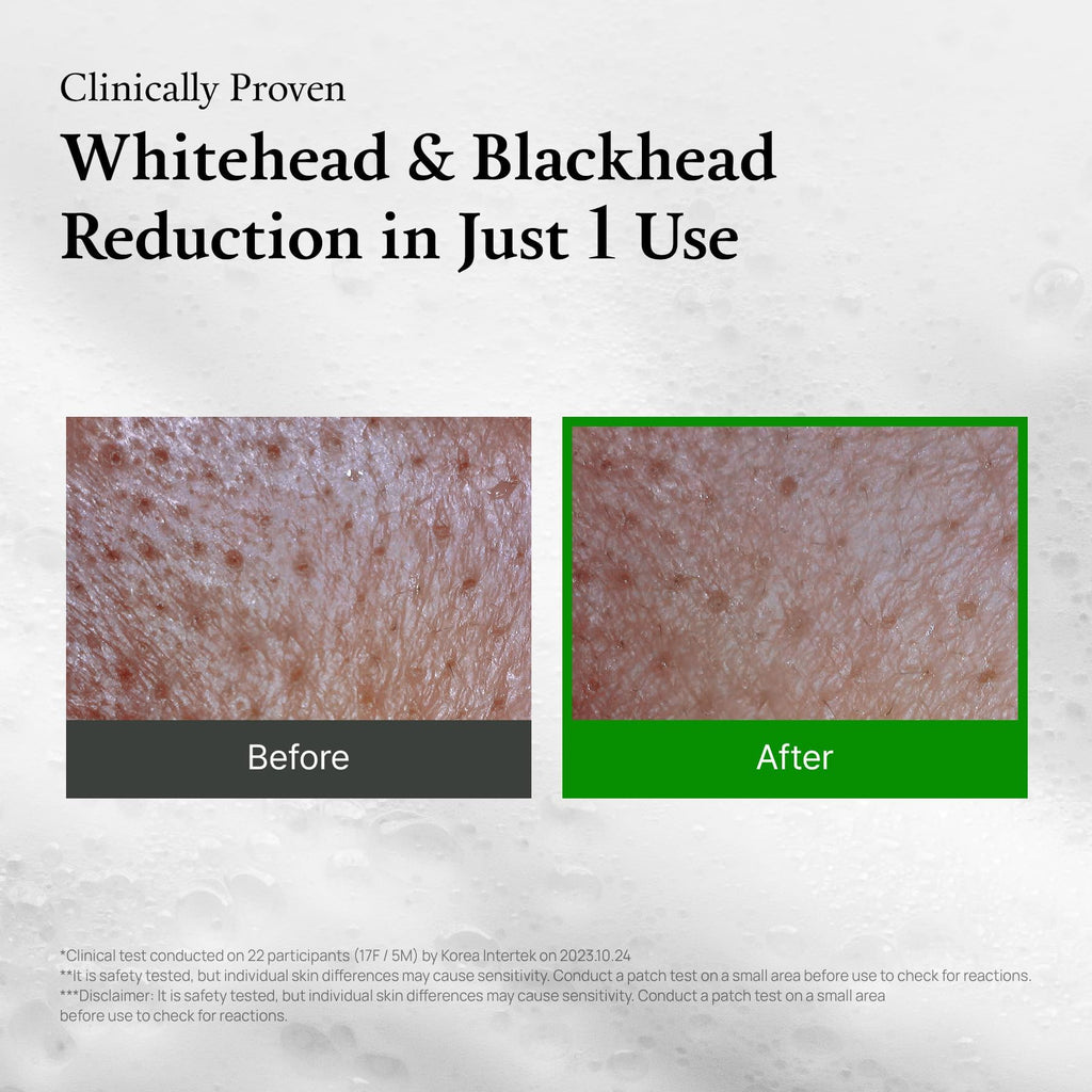 FULLY Green Tomato Facial Cleanser, Cardi B’s Clay Mask Cleanser for Deep Pore Cleanse