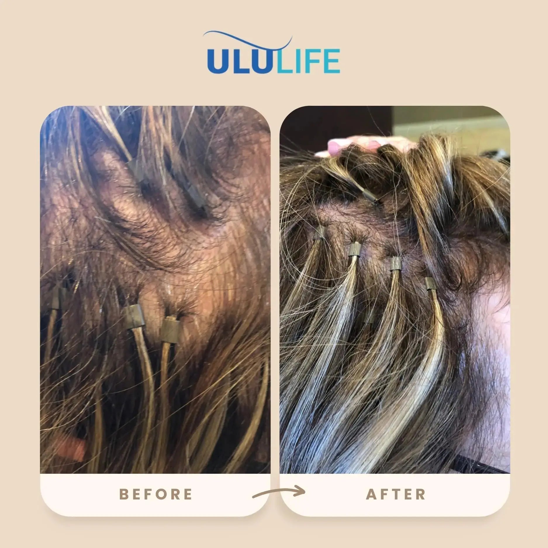 ULULIFE Complete Multivitamin for Men & Women: All-Natural & Cruelty Free with Biotin, Collagen, Keratin, & More - Promotes Hair Growth & Thickness ULULIFE Au supplements