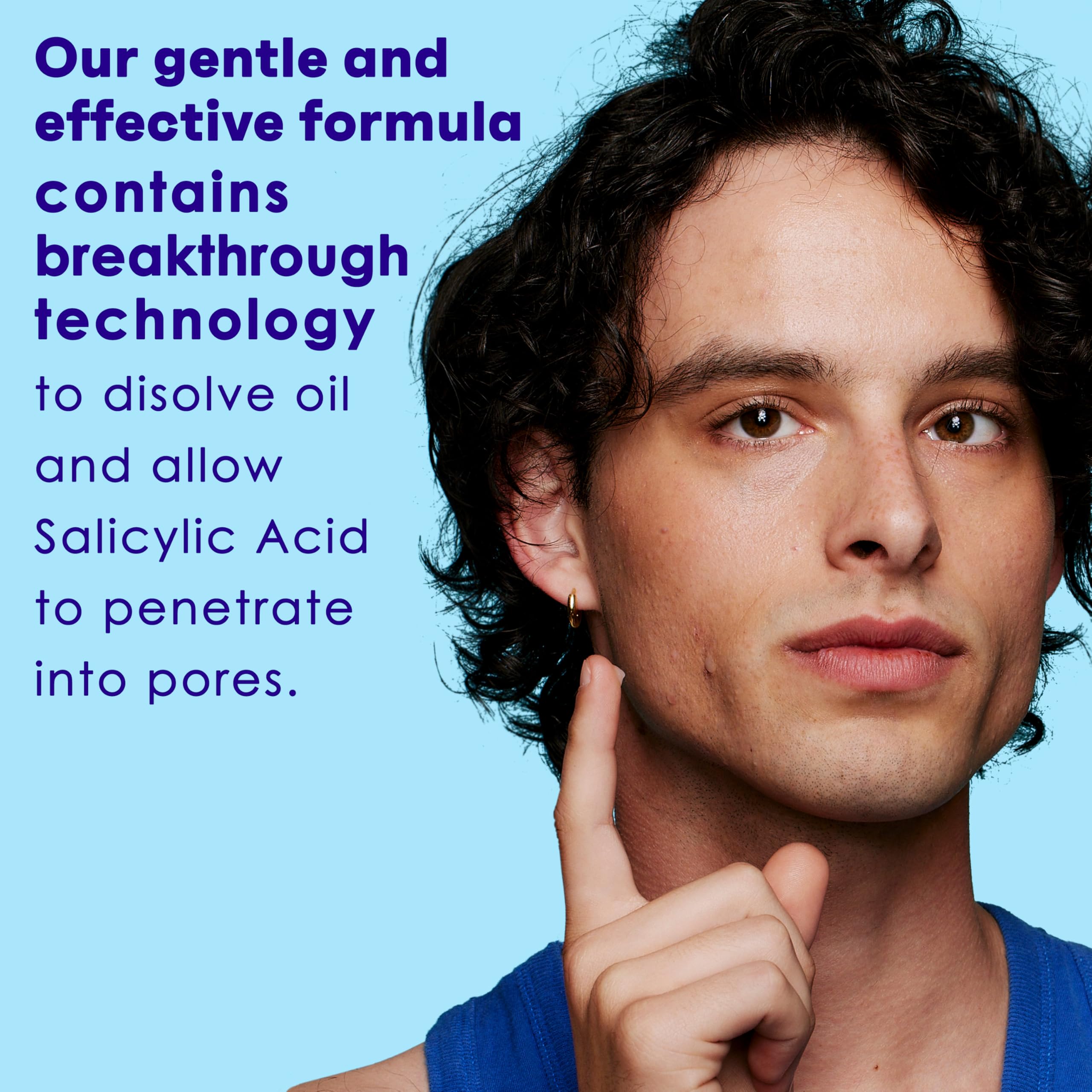 Clean and Clear Advantage Acne Spot Treatment Gel Cream with 2% Salicylic Acid & Witch Hazel, Acne Pimple Medication