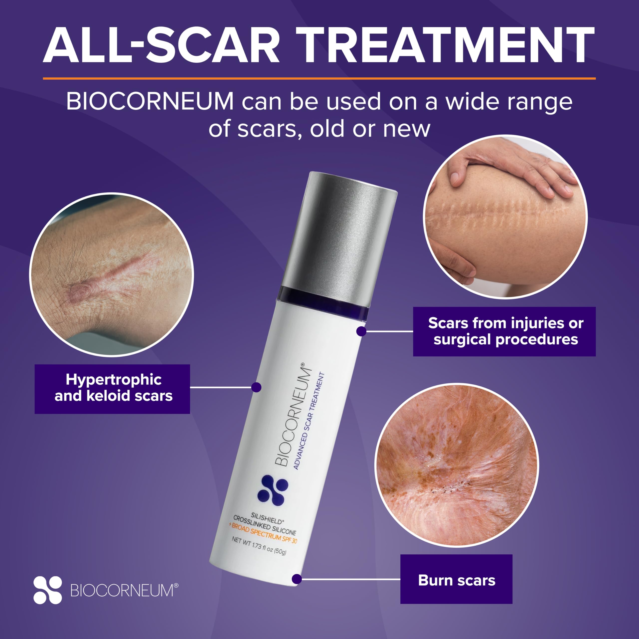Biocorneum Advanced Scar Treatment with Silishield® & SPF 30 10g – Medical Grade Silicone Gel to Support Healing of Surgical Scars and Marks