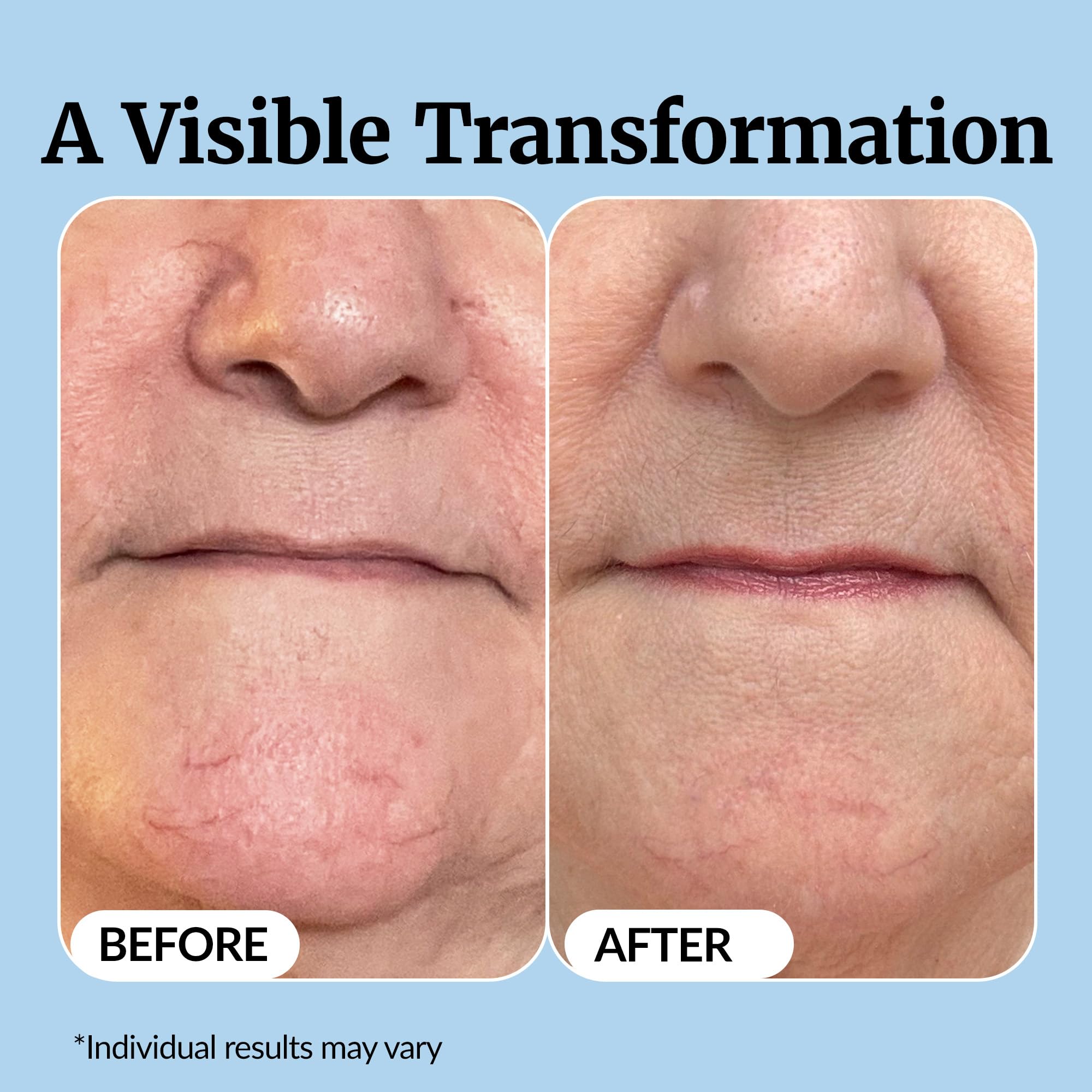 Vibriance Super C Serum for Mature Skin - All-in-One Vitamin Formula Hydrates, Firms,