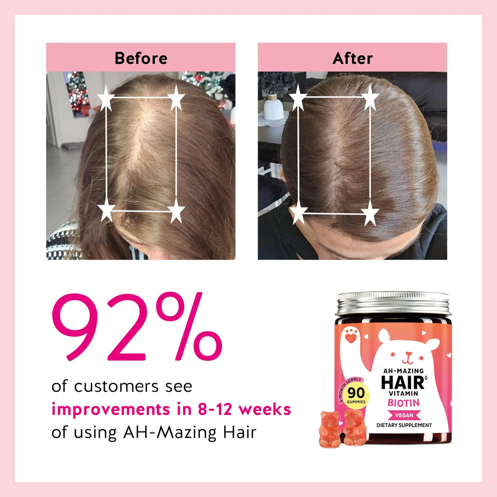 Biotin Gummies for Hair, Skin & Nails. 5,000 mcg High Potency Vegan Vitamins for Faster Hair Growth, Stronger Nails & Healthy Skin. with Vitamins C & E, 90 Gummies Bears with Benefits Au supplements