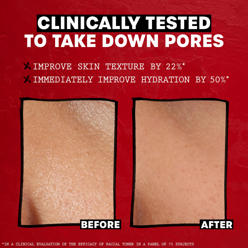 THAYERS Alcohol-Free Rose Petal Witch Hazel Facial Toner for Glowing Skin, Soothing