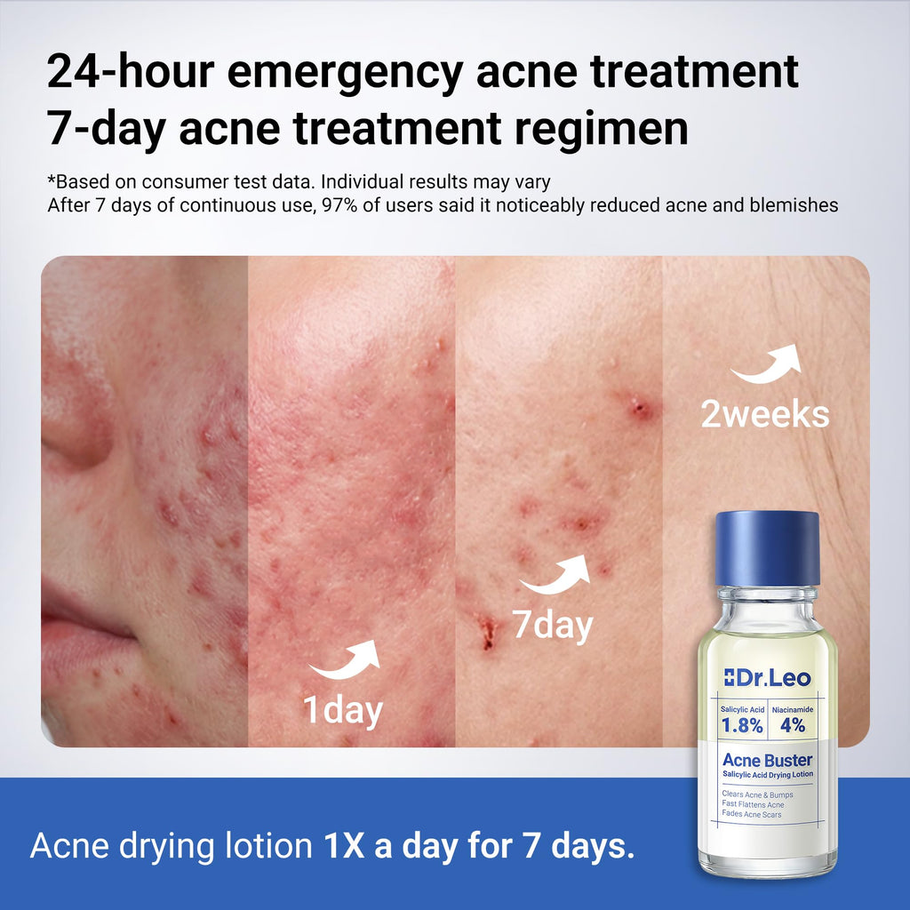 Dr.Leo 1.8% Salicylic Acid Spot Serum, Acne Treatment for Acne-Prone Sensitive Skin | Niacinamide, Fast Pimple Relief, Fades Acne Marks