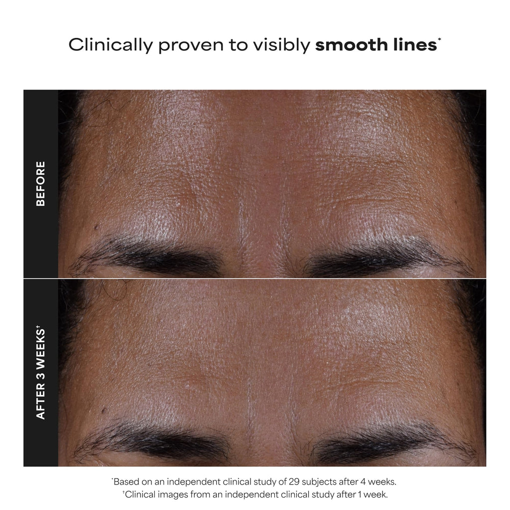 Paulas Choice--SKIN PERFECTING 2% BHA Liquid Salicylic Acid Exfoliant--Facial Exfoliant for Blackheads, Enlarged Pores, Wrinkles & Fine Lines, 4 oz Bottle Paula's Choice Au supplements