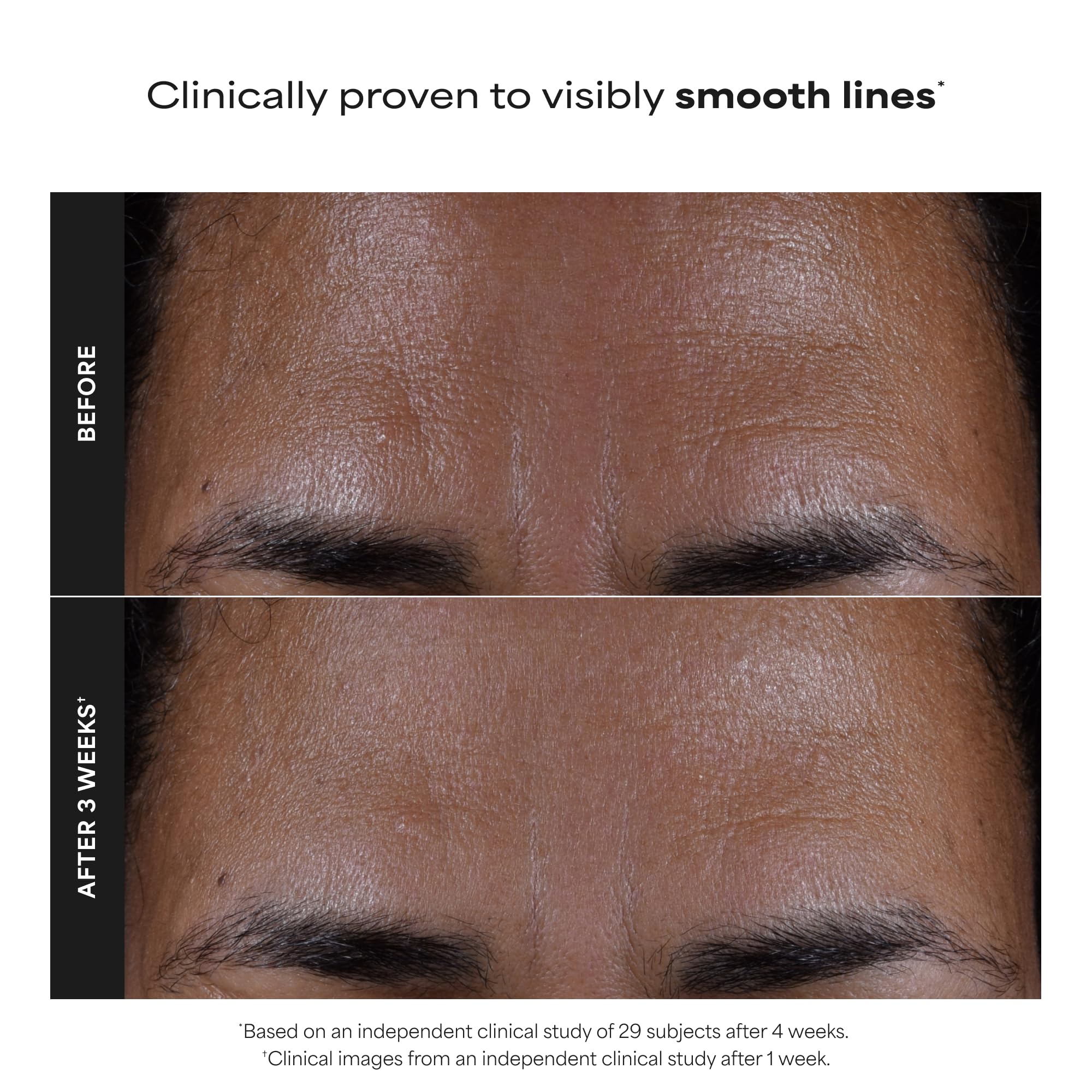 Paulas Choice--SKIN PERFECTING 2% BHA Liquid Salicylic Acid Exfoliant--Facial Exfoliant for Blackheads, Enlarged Pores, Wrinkles & Fine Lines, 4 oz Bottle Paula's Choice Au supplements