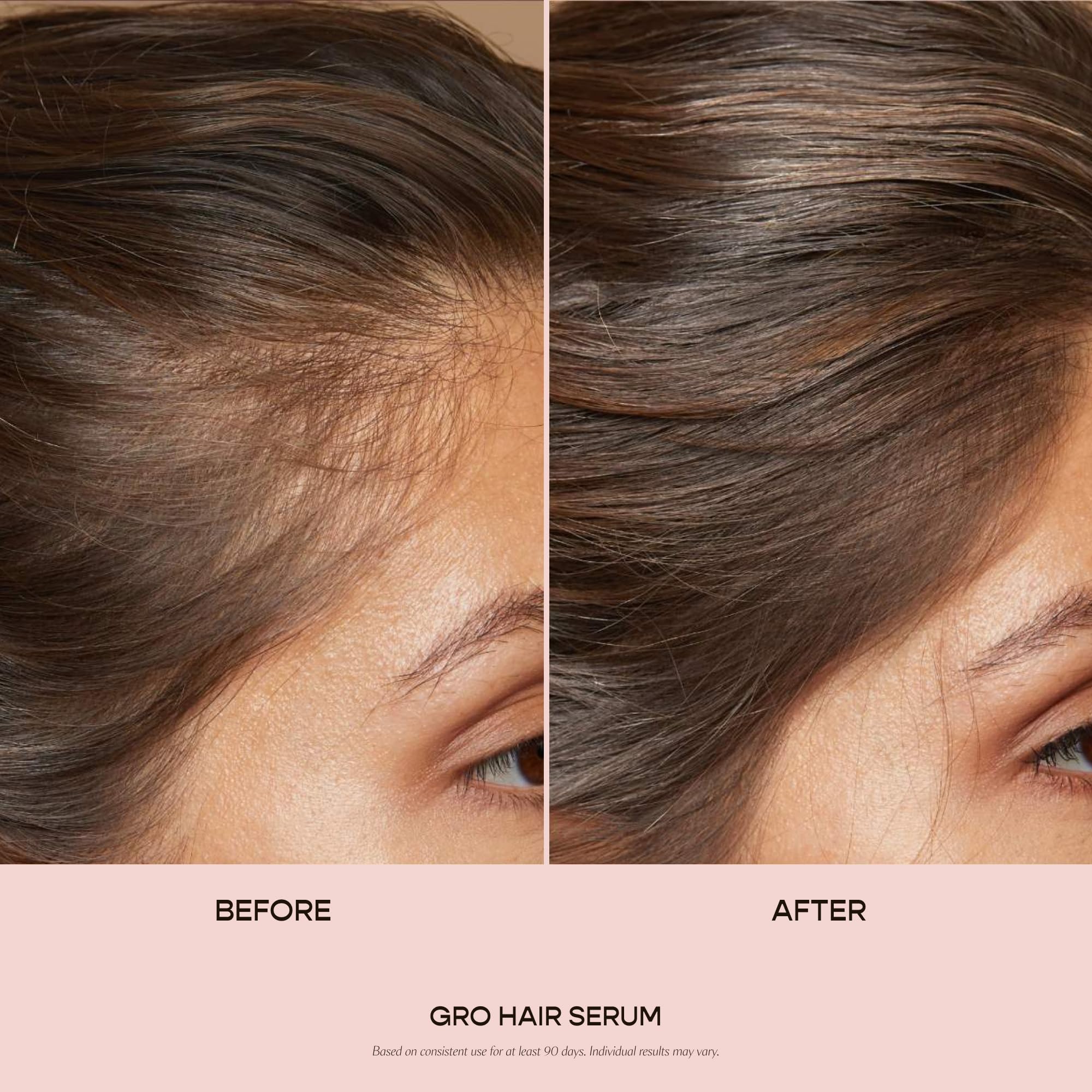 VEGAMOUR GRO Hair Serum for Hair Thinning, Thicker Fuller Looking Hair, Non Oily Tonic for Healthier Scalp, 30 day Supply 1.0 fl oz, 1 pack VEGAMOUR Au supplements