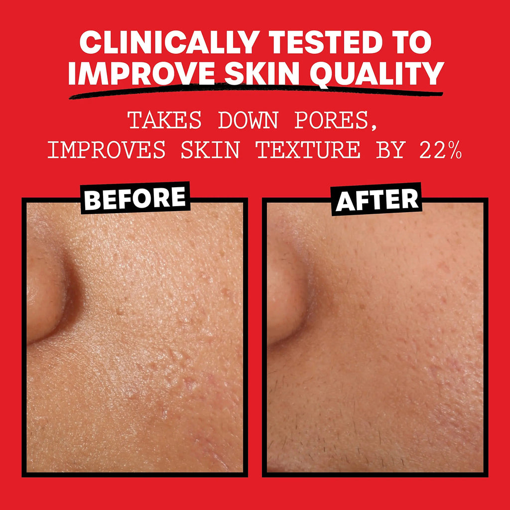 Thayers Alcohol-Free, Hydrating Rose Petal Witch Hazel Facial Toner 12 oz + 3oz THAYERS Au supplements