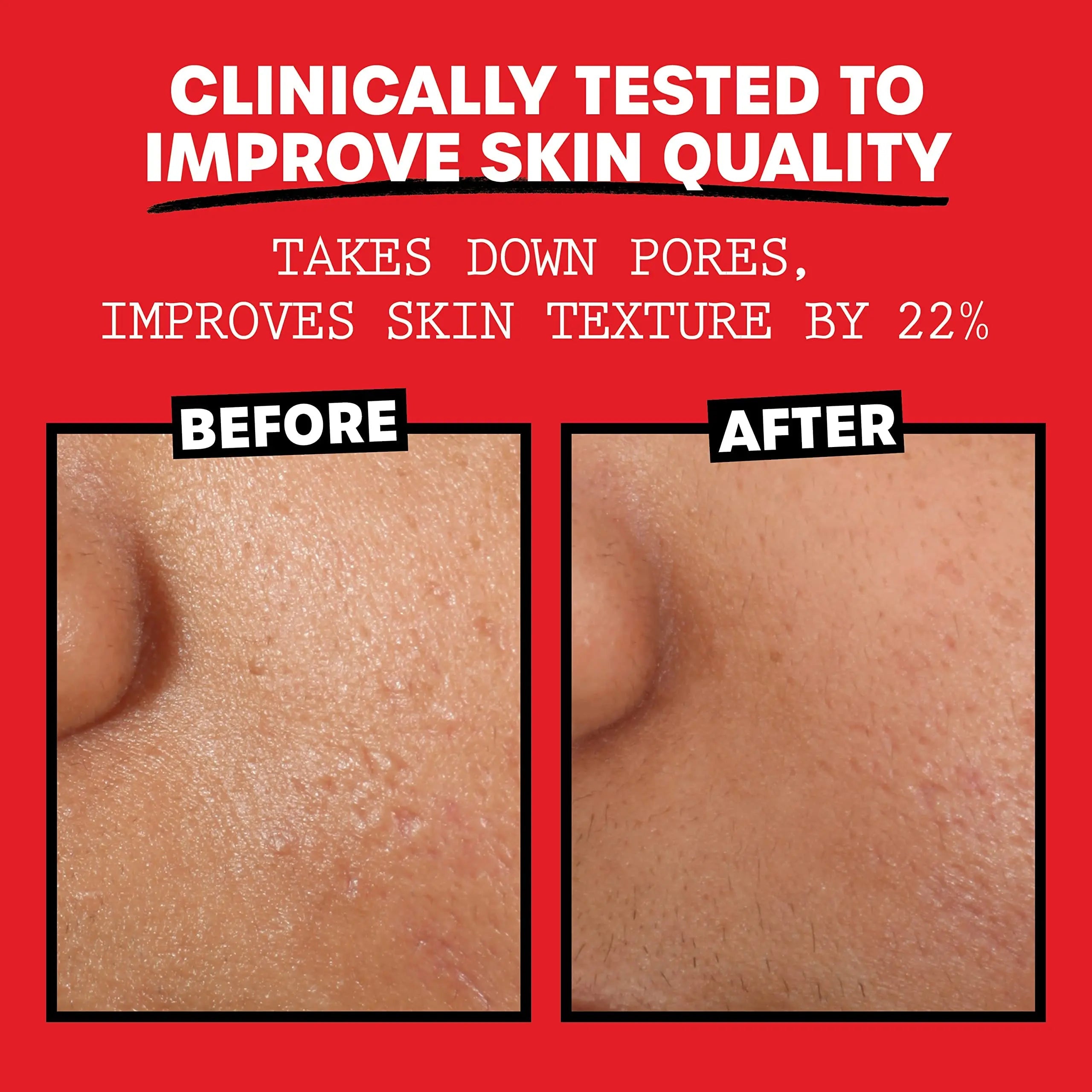 Thayers Alcohol-Free, Hydrating Rose Petal Witch Hazel Facial Toner 12 oz + 3oz THAYERS Au supplements