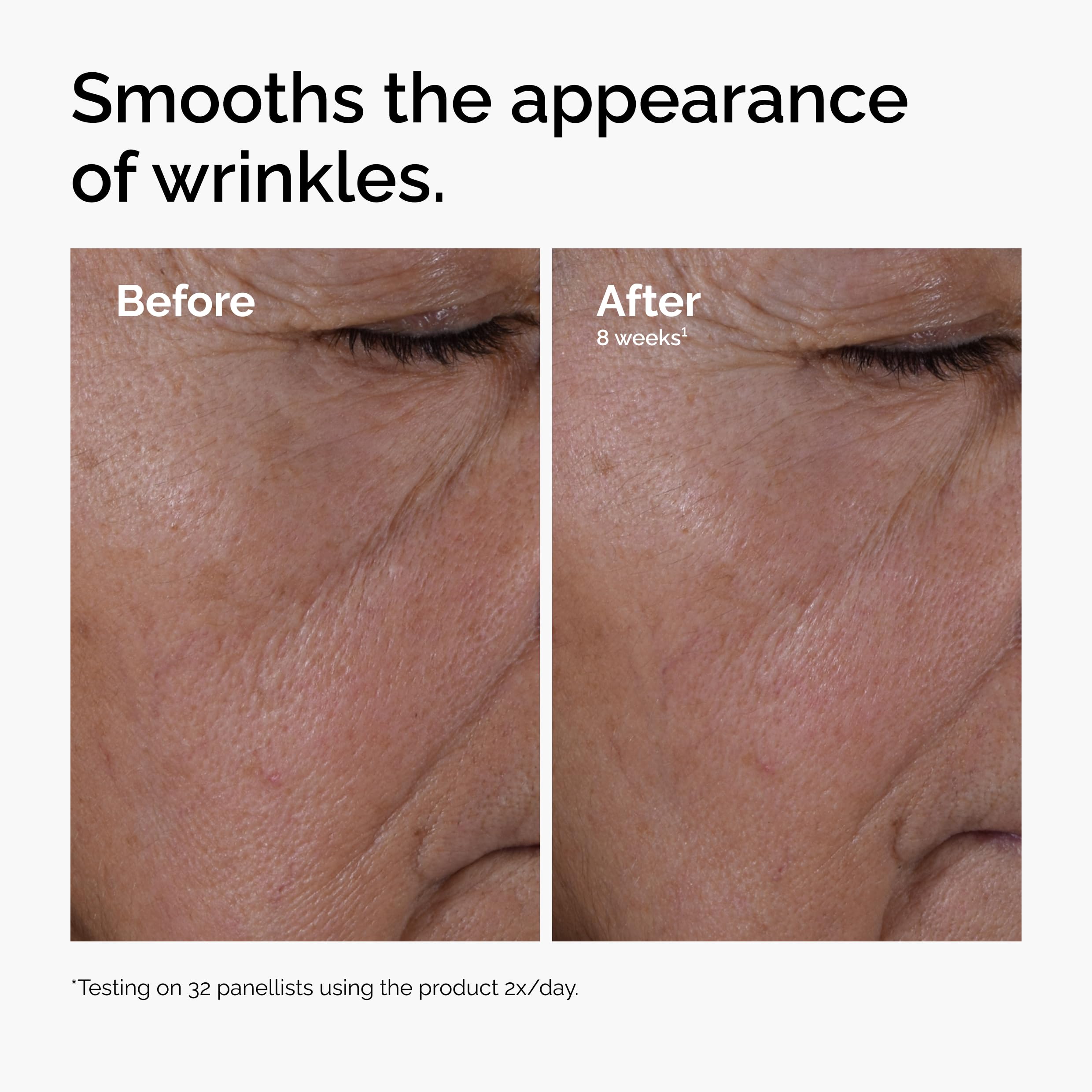 The Ordinary Multi-Peptide + Hyaluronic Acid, Anti-Aging Peptide Serum for Crow’s Feet
