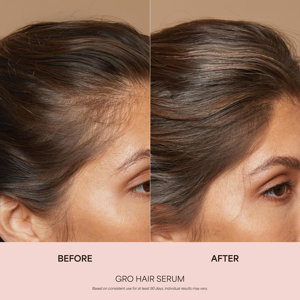 VEGAMOUR GRO Healthy Hair Starter Kit | Full Size GRO Serum for Thinning & Shedding plus Travel Size Shampoo and Conditioner with Vegan Keratin to Support Thicker, Fuller Looking Locks | $92 Value VEGAMOUR Au supplements