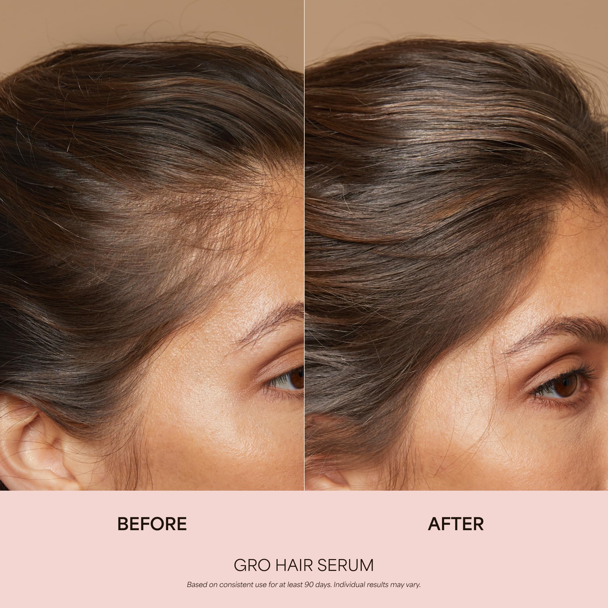 VEGAMOUR GRO Healthy Hair Starter Kit | Full Size GRO Serum for Thinning & Shedding plus Travel Size Shampoo and Conditioner with Vegan Keratin to Support Thicker, Fuller Looking Locks | $92 Value VEGAMOUR Au supplements
