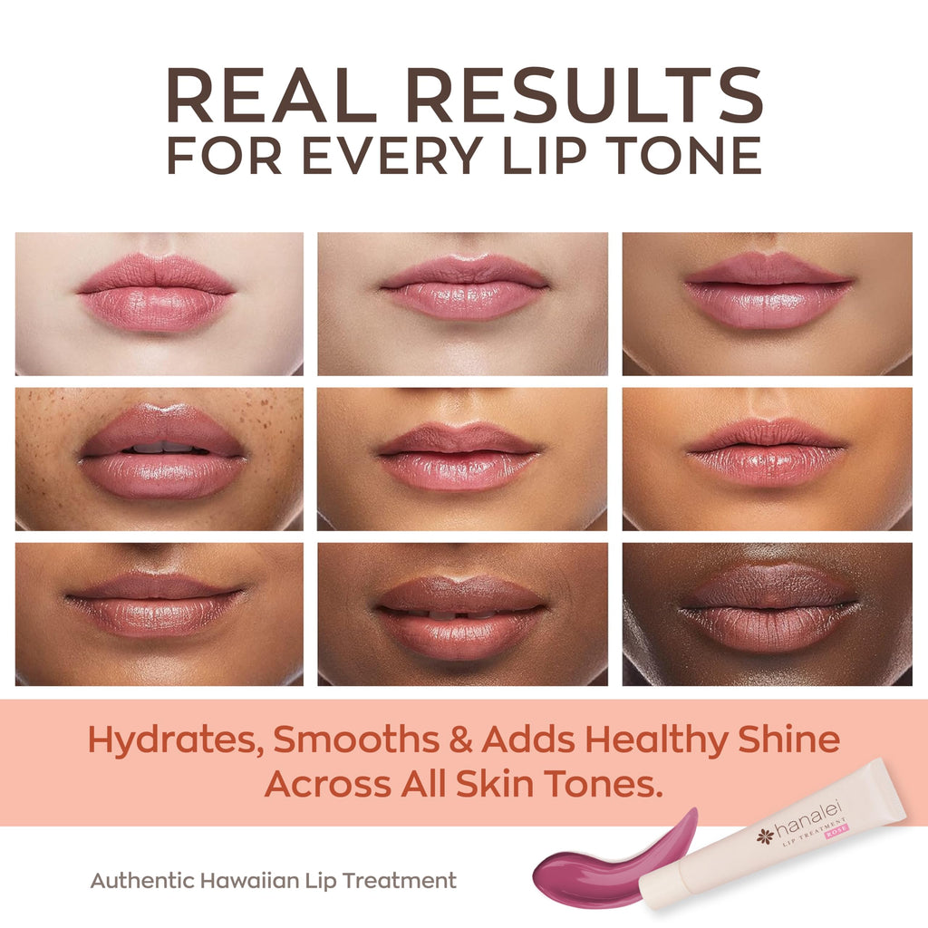 Hanalei Lip Treatment for Dry, Chapped Lips – Intensive Overnight Moisturizer with Kukui Oil