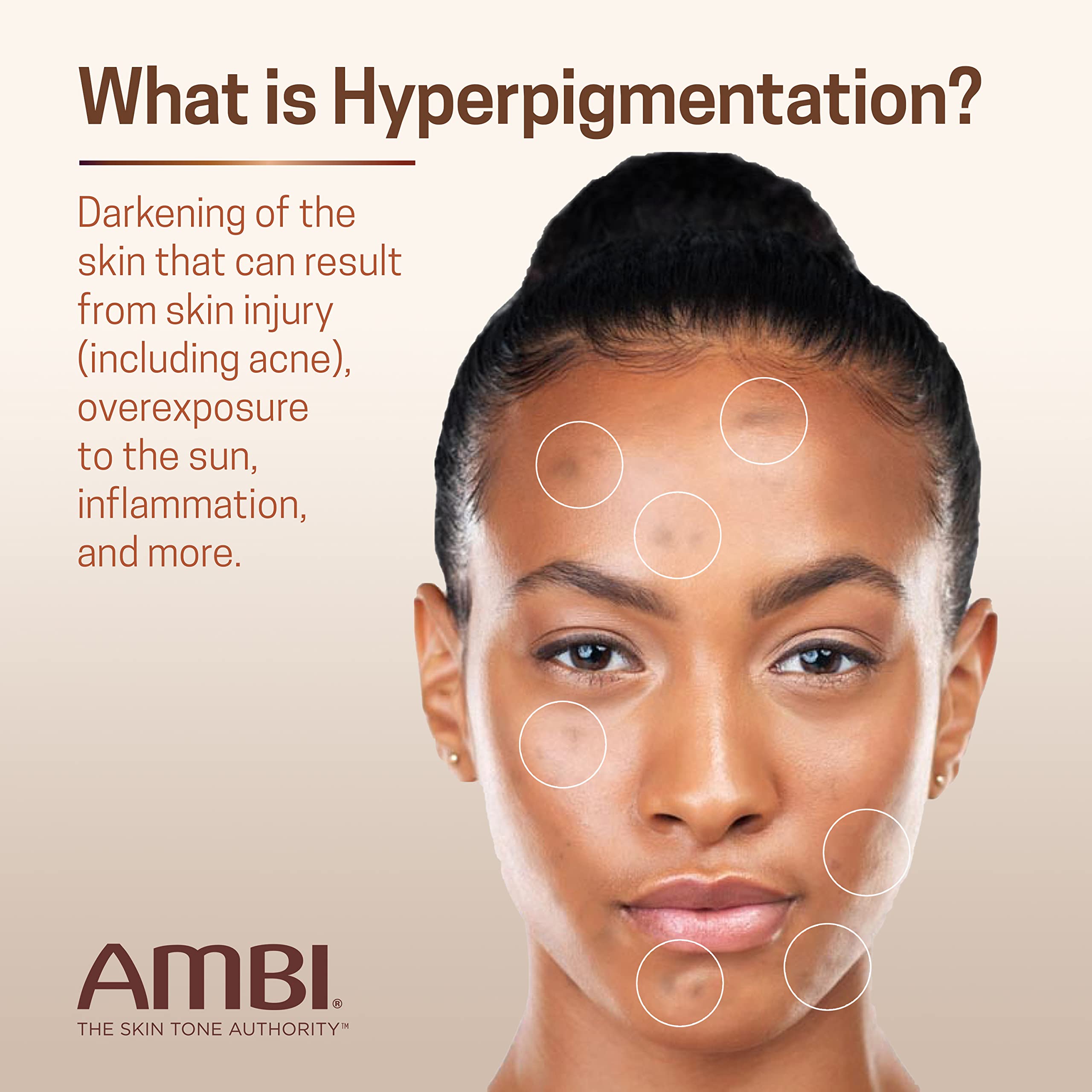 Ambi Even & Clear Advanced Fade Cream, Hydroquinone-free, Hyperpigmentation Treatment, Stubborn Dark Spot Corrector, Results In As Little As 2-3 Weeks