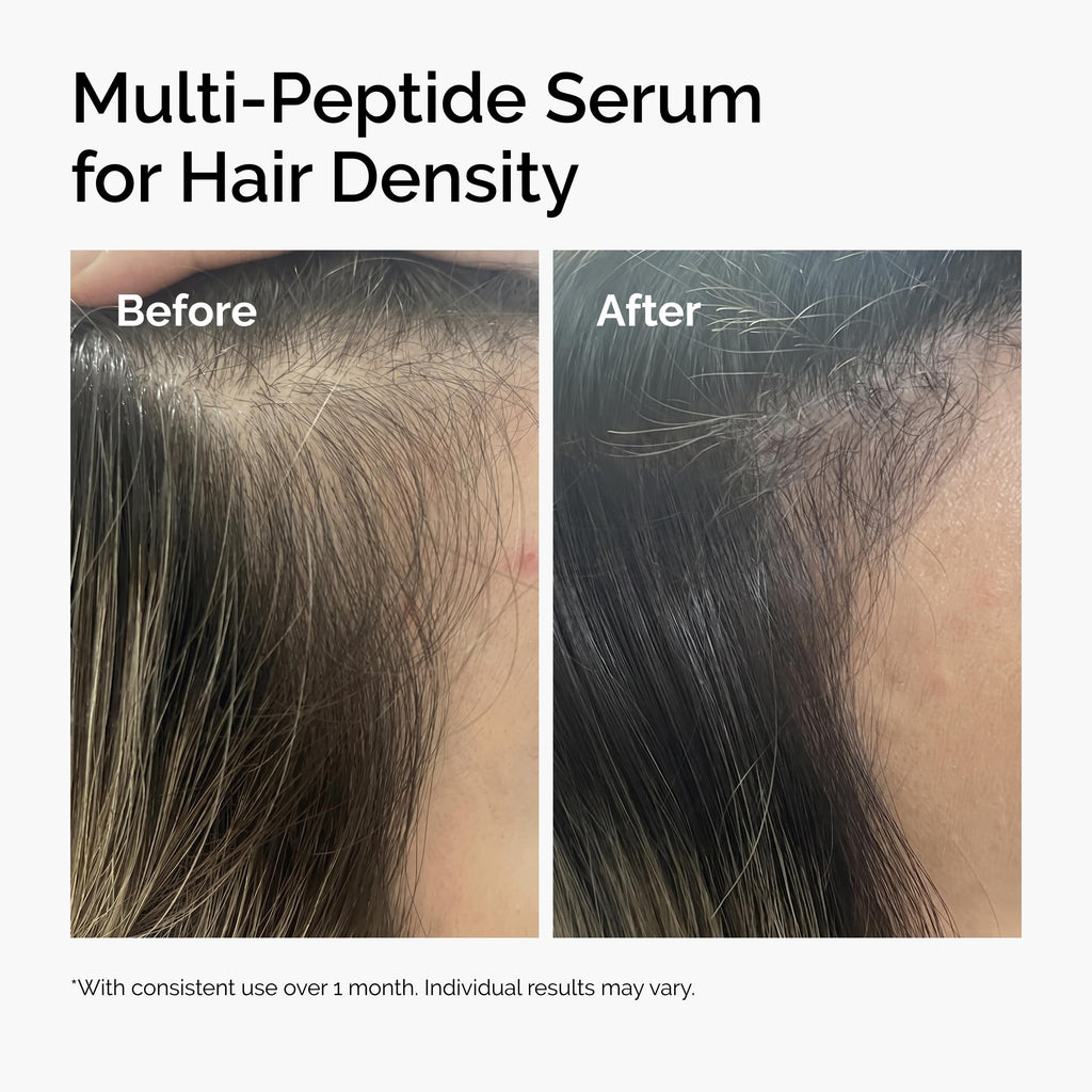 The Ordinary Multi-Peptide Serum for Hair Density, Peptide-Powered Formula for Thicker, Fuller Looking Hair, 2 Fl Oz The Ordinary Au supplements