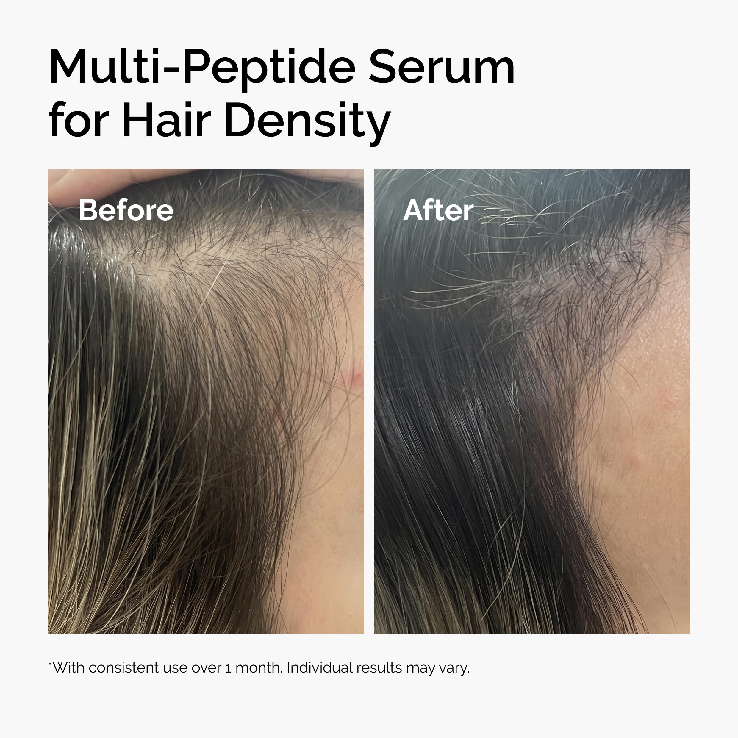 The Ordinary Multi-Peptide Serum for Hair Density, Peptide-Powered Formula for Thicker, Fuller Looking Hair, 2 Fl Oz The Ordinary Au supplements