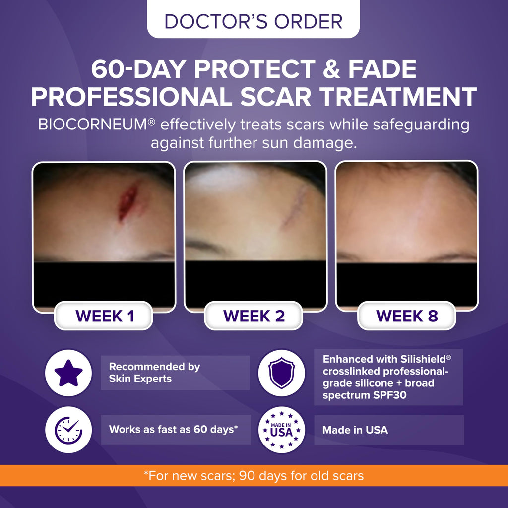 Biocorneum Advanced Scar Treatment with Silishield® & SPF 30 10g – Medical Grade Silicone Gel to Support Healing of Surgical Scars and Marks