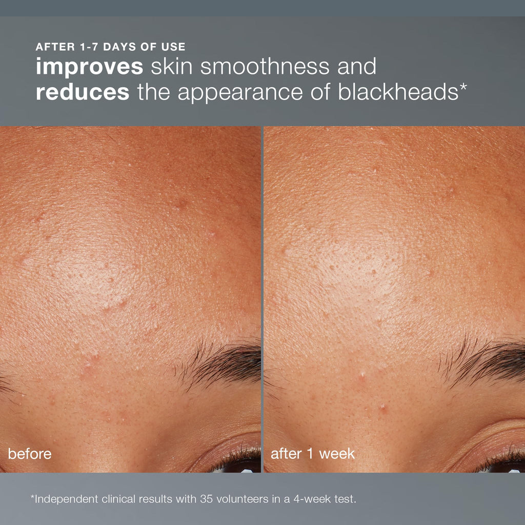 Dermalogica Daily Microfoliant, Face Exfoliator Scrub Powder with Salicylic Acid and Papaya