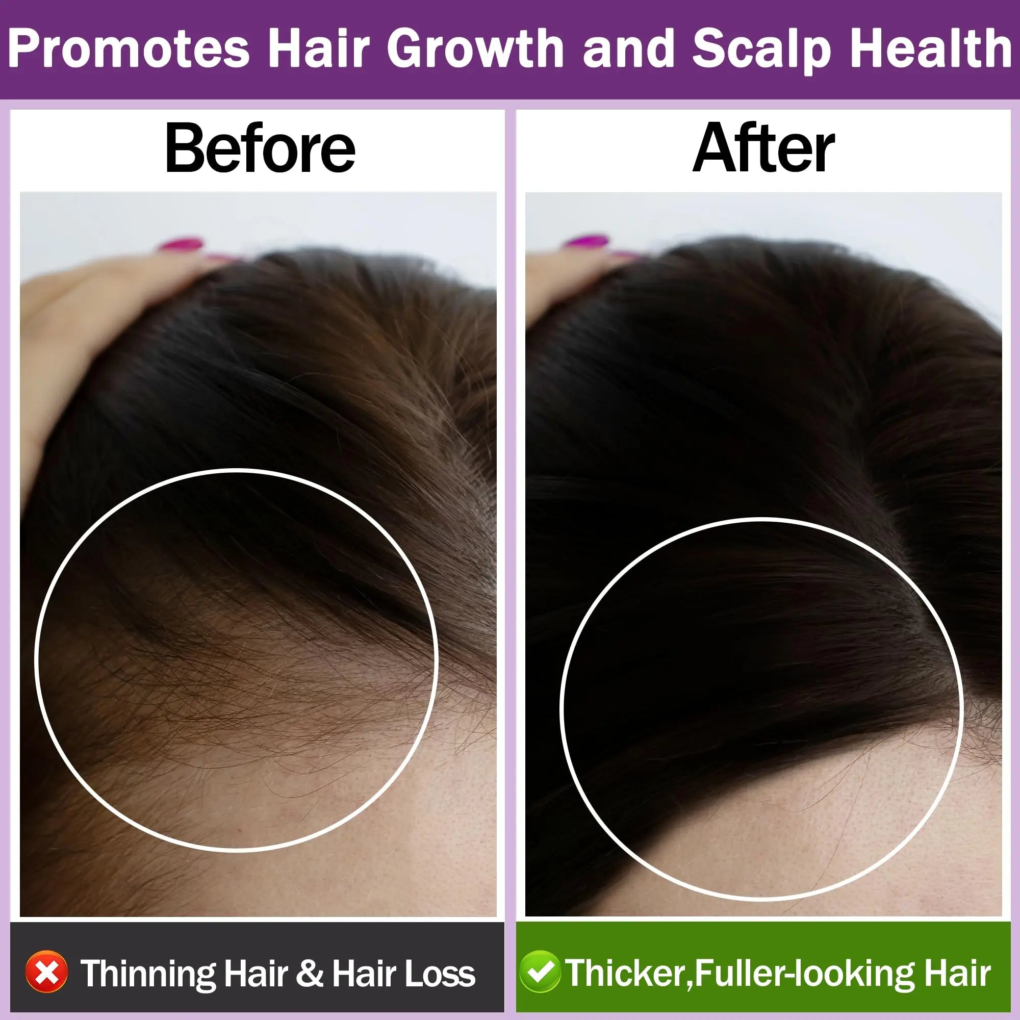 Rosemary Oil for Hair Growth,100% Pure Undiluted Light-Weight Non-Greasy Rosemary Essential Oil GIFBEA Au supplements