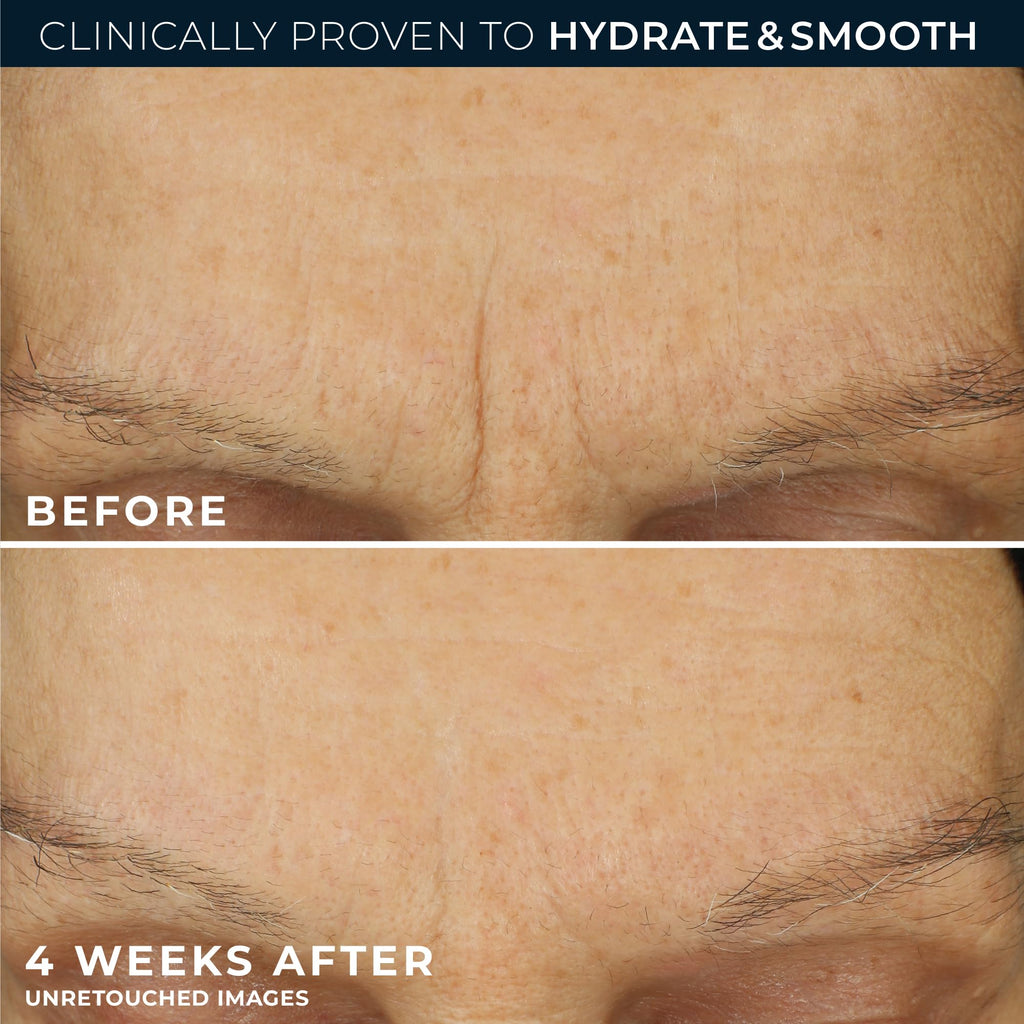 RoC Retinol Correxion Max Daily Hydration Anti-Aging Face Moisturizer with Hyaluronic Acid