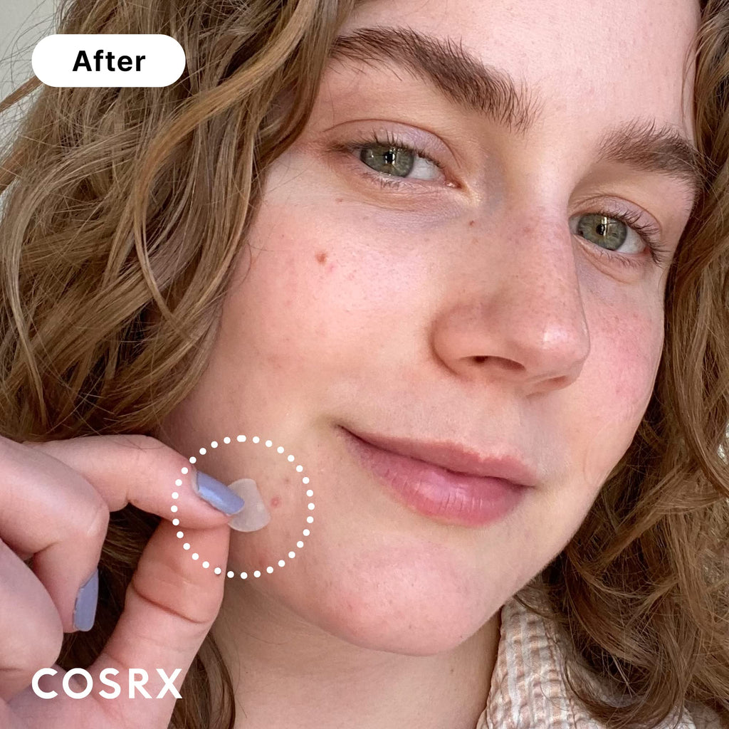 COSRX Acne Pimple Patch (96) Absorbing Hydrocolloid Original 3 Size Patches for Blemishes and Zits Cover