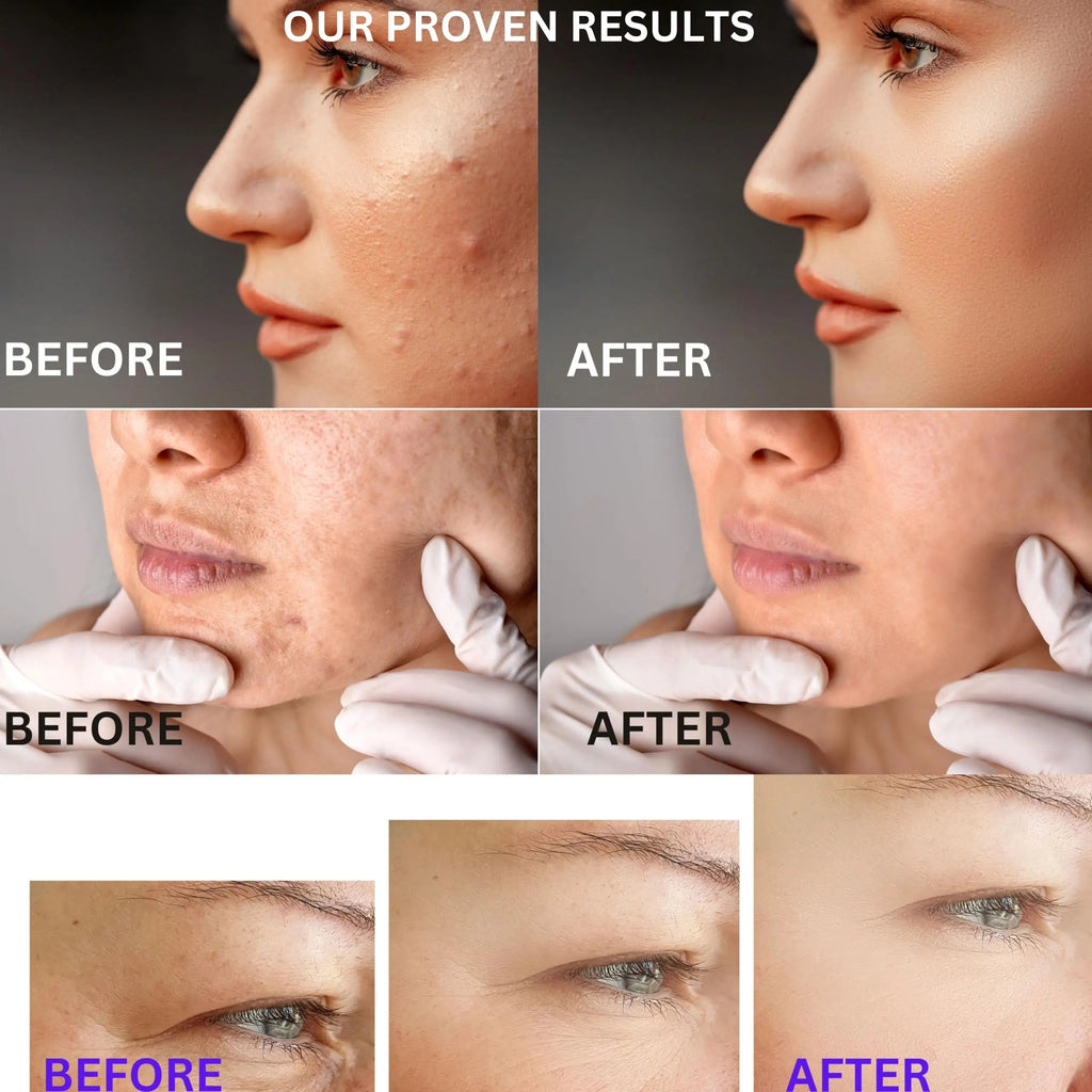 SkinVitalize C E ferulux Vitamin C Serum - 30ml: Advanced Formula for Fighting with Wrinkles Msupps.com Au supplements