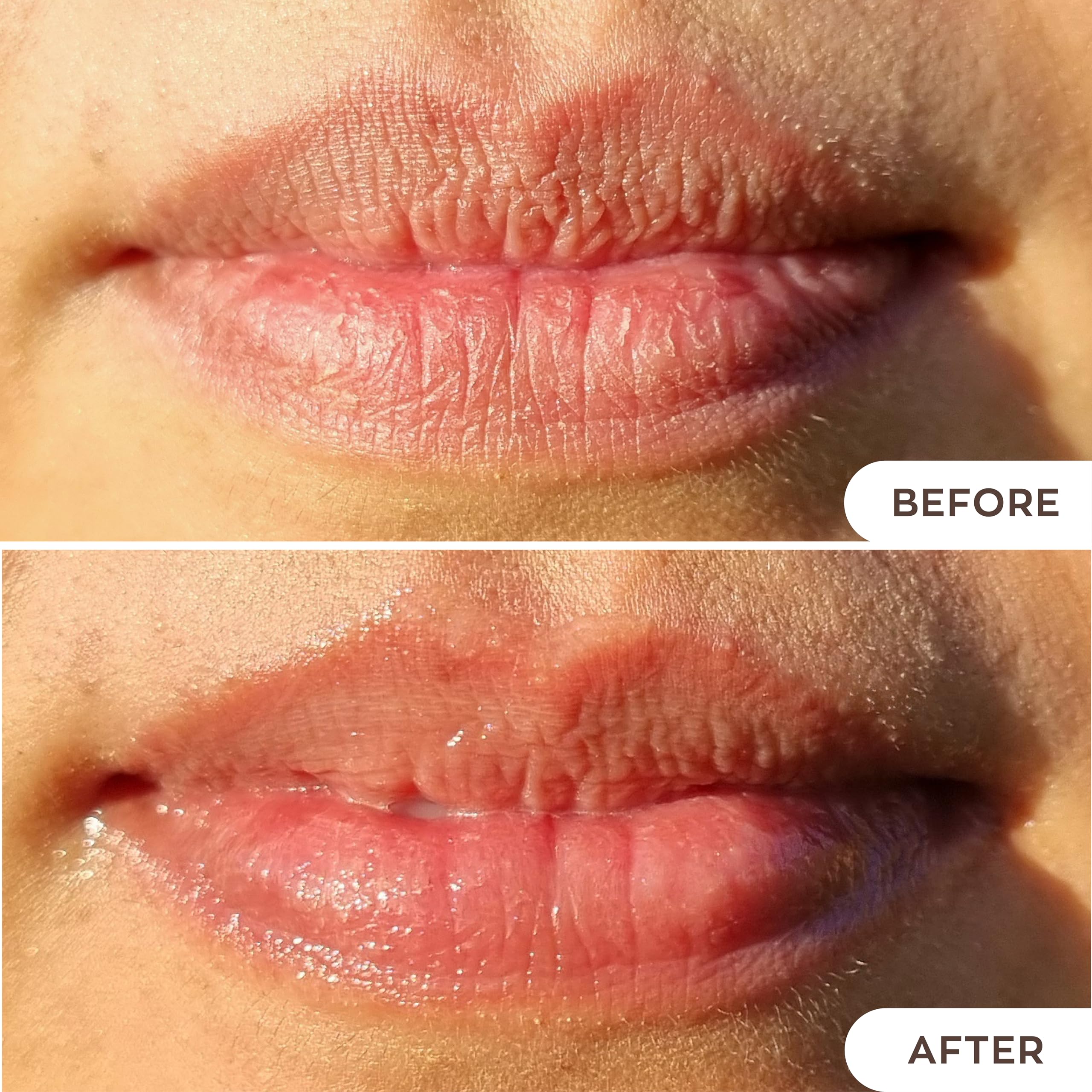 Hanalei Lip Treatment for Dry, Chapped Lips – Intensive Overnight Moisturizer with Kukui Oil