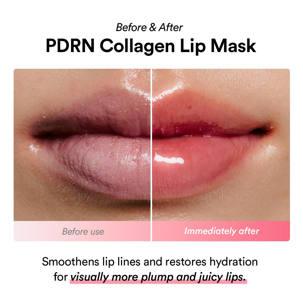 Abib PDRN Collagen Lip Mask Glazed Jelly 0.38 fl oz | Korean Lip Butter Balm Overnight Sleeping Mask Hydrating Care Moisturizer Treatment for Flakey, Dry Lips - TrustMedUSA