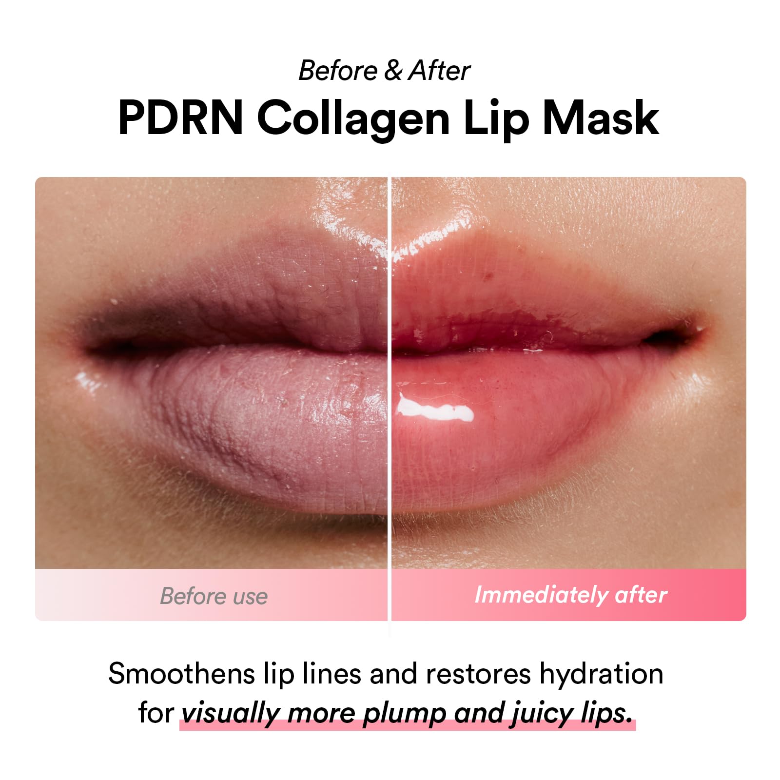 Abib PDRN Collagen Lip Mask Glazed Jelly 0.38 fl oz | Korean Lip Butter Balm Overnight Sleeping Mask Hydrating Care Moisturizer Treatment for Flakey, Dry Lips - TrustMedUSA