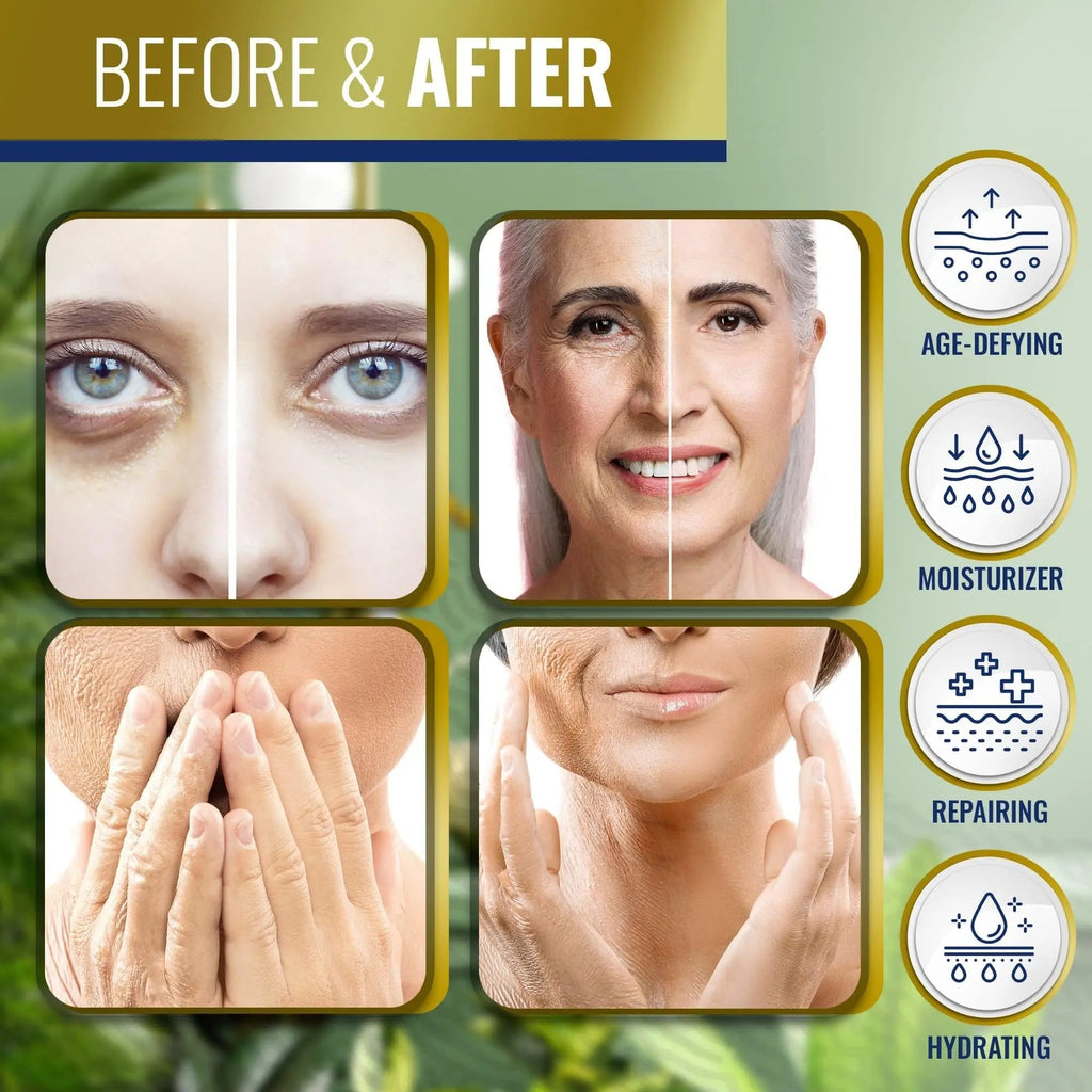 Advanced Clinicals Retinol Body Butter Lotion Moisturizer Face Lotion & Body Cream - TrustMedUSA