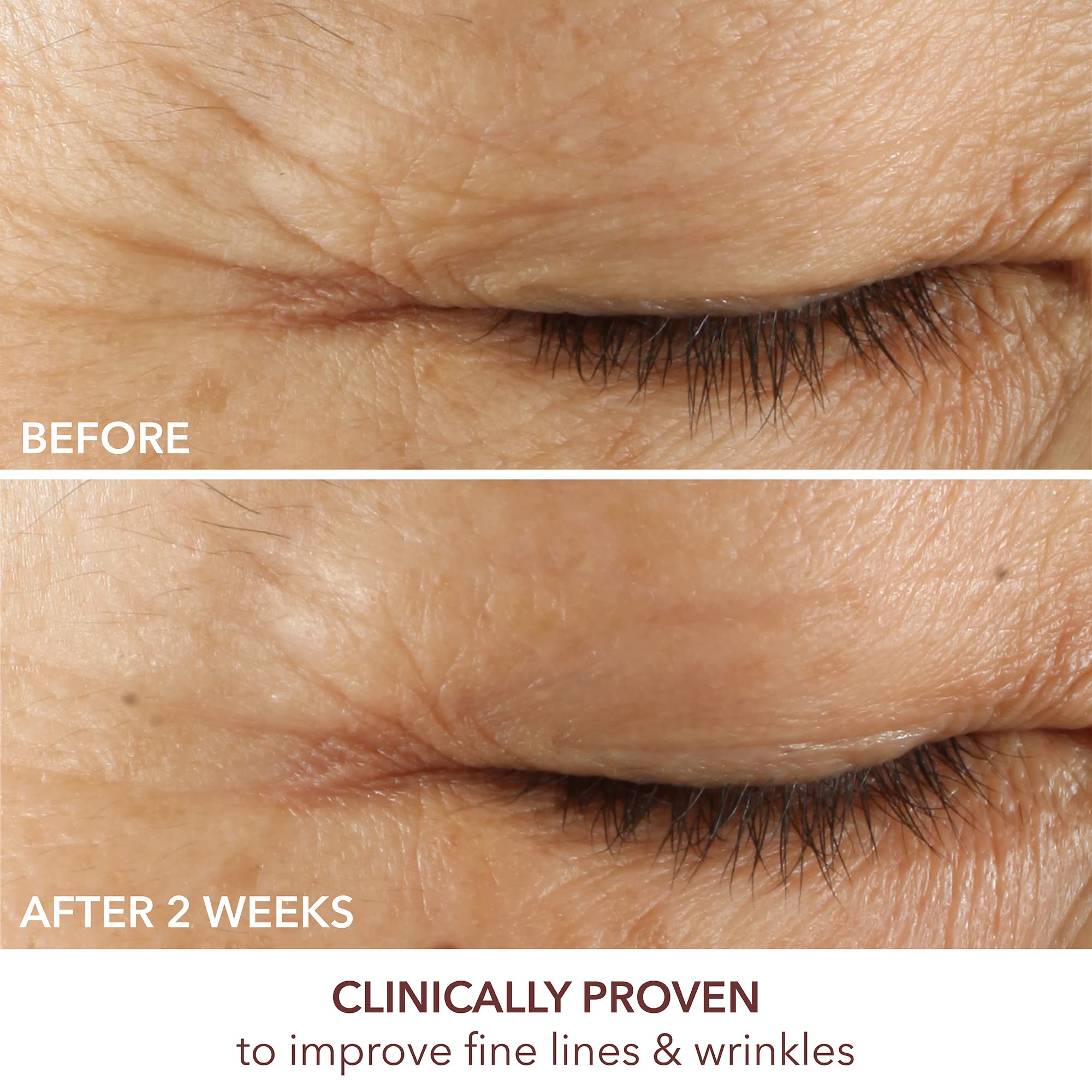 Advanced Retinol + Ferulic Triple Correction Eye Serum -15ml/0.5oz - Maple Wellness Supplements