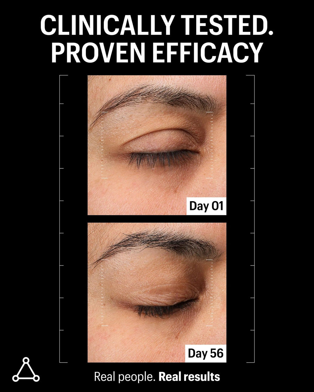 Allies of Skin Multi Peptides & Growth Factor Collagen Boosting Face Serum | Skin Tightening Anti-Aging Complex with 9% Peptides| Firms Sagging Skin & Visibly Reduces Wrinkles (1 oz) - TrustMedUSA