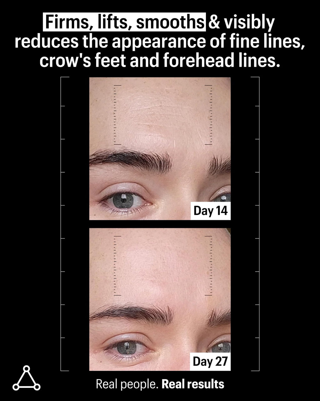 Allies of Skin Multi Peptides & Growth Factor Collagen Boosting Face Serum | Skin Tightening Anti-Aging Complex with 9% Peptides| Firms Sagging Skin & Visibly Reduces Wrinkles (1 oz) - TrustMedUSA
