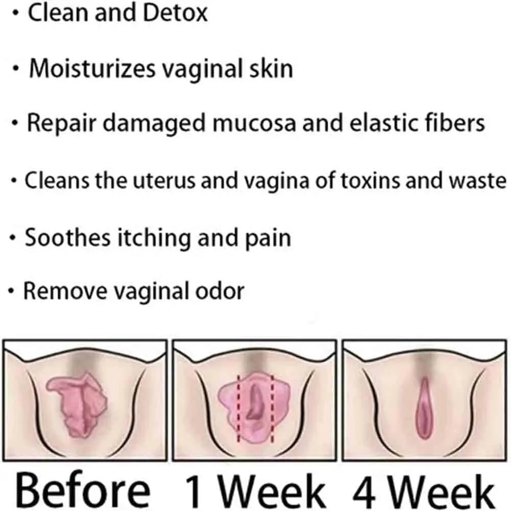 AnnieCare Instant Anti-Itch Detox Products, Annie Care Capsulas, Firming Repair & Pink - TrustMedUSA
