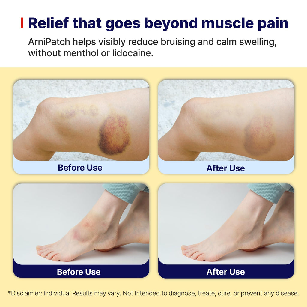 Arnica Hydrogel Pain Relief Patches | Natural Relief for Muscle, Joint, Bruises & Swelling | Flexible, Non-Greasy & Long-Lasting | Great for Back, Knee & Neck Pain (3.9"x4.7", 10, Count) - TrustMedUSA