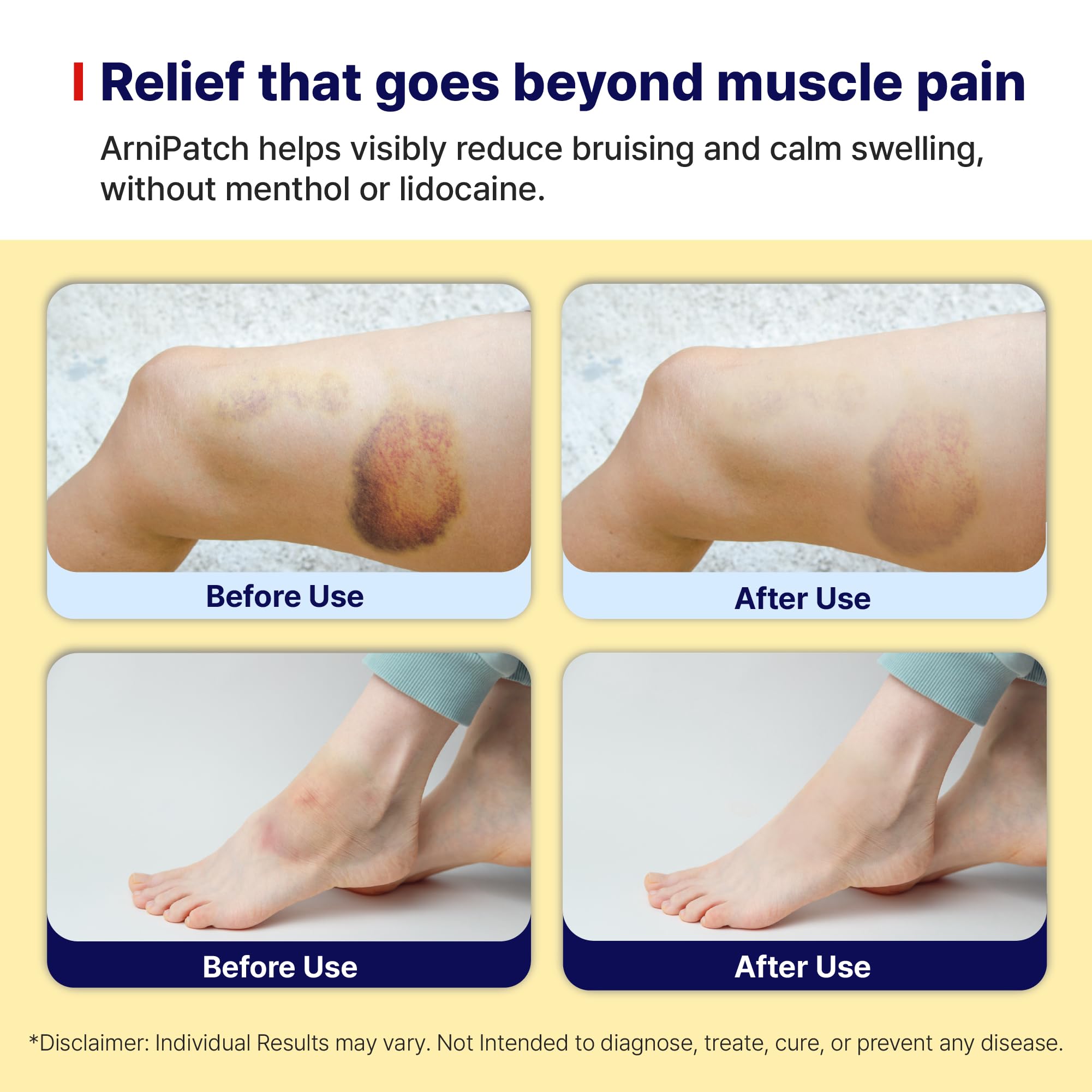 Arnica Hydrogel Pain Relief Patches | Natural Relief for Muscle, Joint, Bruises & Swelling | Flexible, Non-Greasy & Long-Lasting | Great for Back, Knee & Neck Pain (3.9"x4.7", 10, Count) - TrustMedUSA