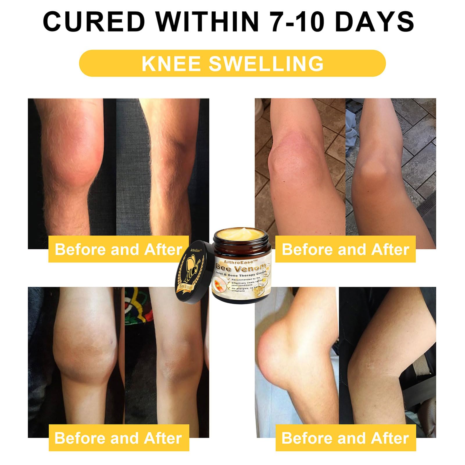 ArthroEase Bee Venom Joint and Bone Cream,ArthroEase Bee Venom Cream,Bee Venom Joint Gel,Effectively Relieve Joint discomfort (2) - TrustMedUSA