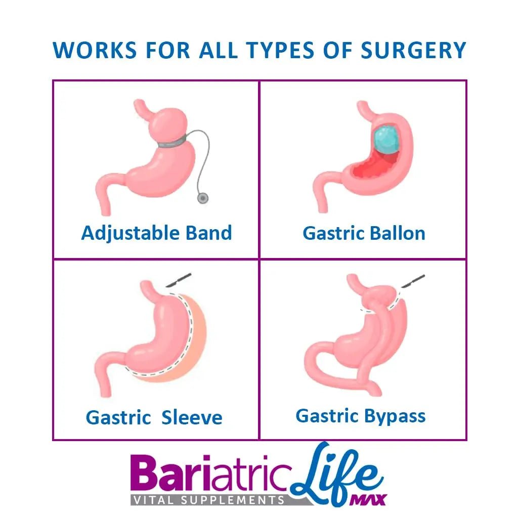 Bariatric Multivitamin Design for Post Bariatric Surgery Mens Patients, Sugar Free, 100+ Vitamins, Minerals & Amino Acids, Supports Muscle, Heart - TrustMedUSA