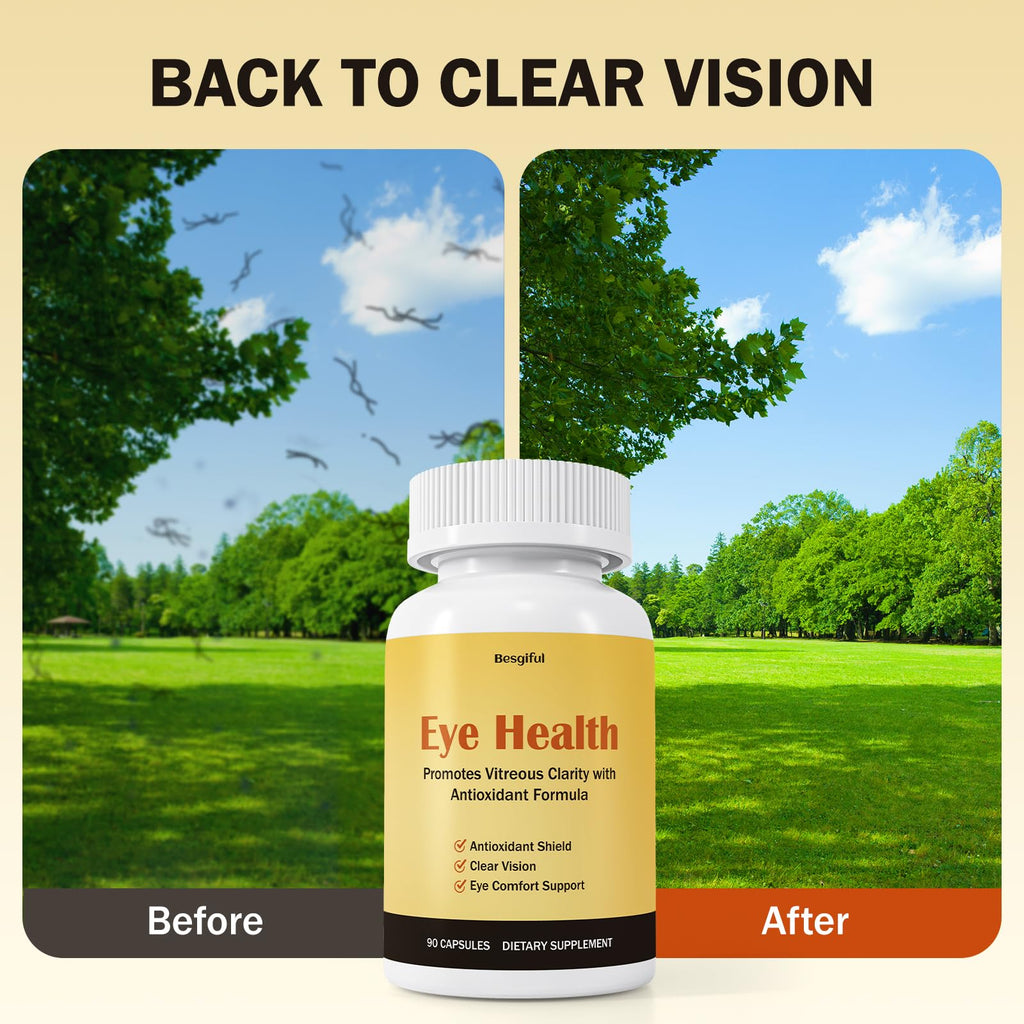 Besgiful Eye Supplement for Vitreous Health, Promotes Clear Vision, Improves Eye Strain & Dryness, Reduces Squiggly Lines, Eye Degeneration, Clear Eye Support, 90 Vegan Capsules - TrustMedUSA