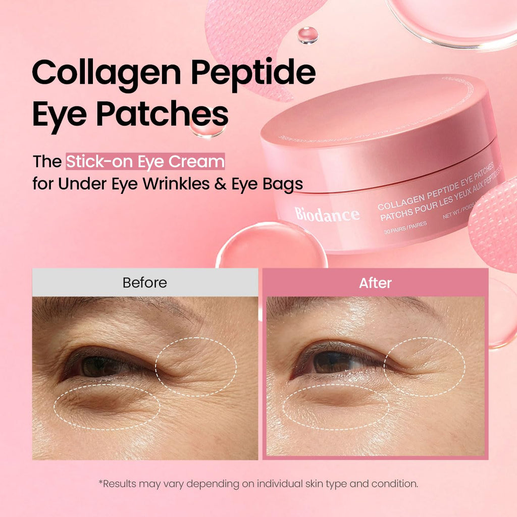 BIODANCE Collagen Peptide Eye Patches, Anti Wrinkle & Smile Line Patches for Face, Under Eye Mask for Fine Lines & Eye Bags - TrustMedUSA