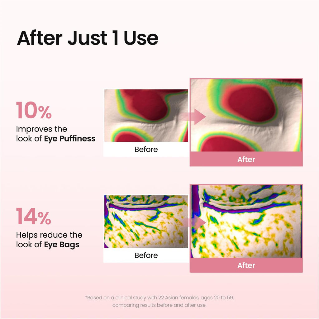 BIODANCE Collagen Peptide Eye Patches, Anti Wrinkle & Smile Line Patches for Face, Under Eye Mask for Fine Lines & Eye Bags - TrustMedUSA