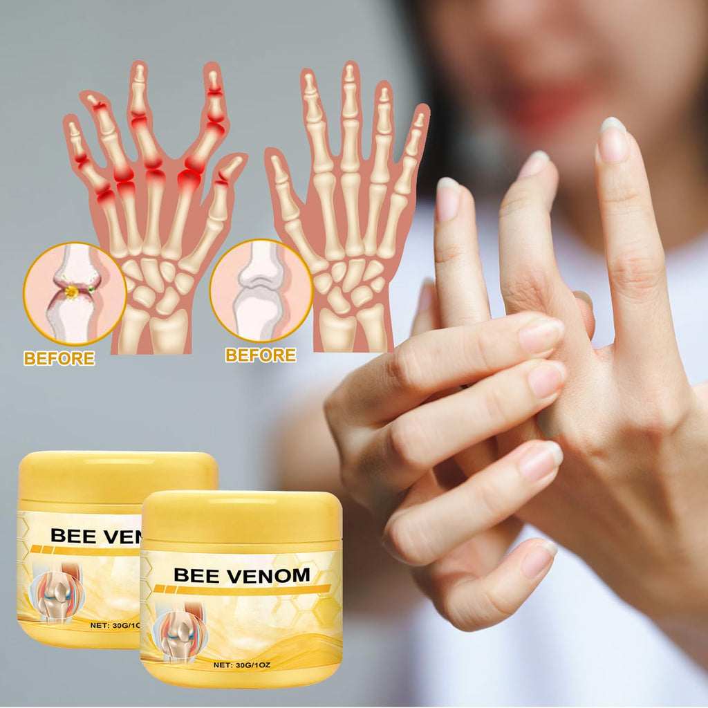 Botou 2PCS New Bee Venom Professional Joint Cream, for Neck, Waist, Back, Hands, Feet and Legs Advanced Bee Propolis Joint Cream, yellow - TrustMedUSA