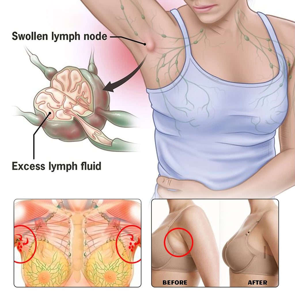 BXQJRJ 24Pcs/Box Herbal Lymph Nodes Patch,Lymphatic Drainage Patch/Patches,Herbal Lymphatic Drainage Care Patch,Neck Lymph Nodes Patch, Lymphatic Massage for Men and Women - Maple Wellness Supplements
