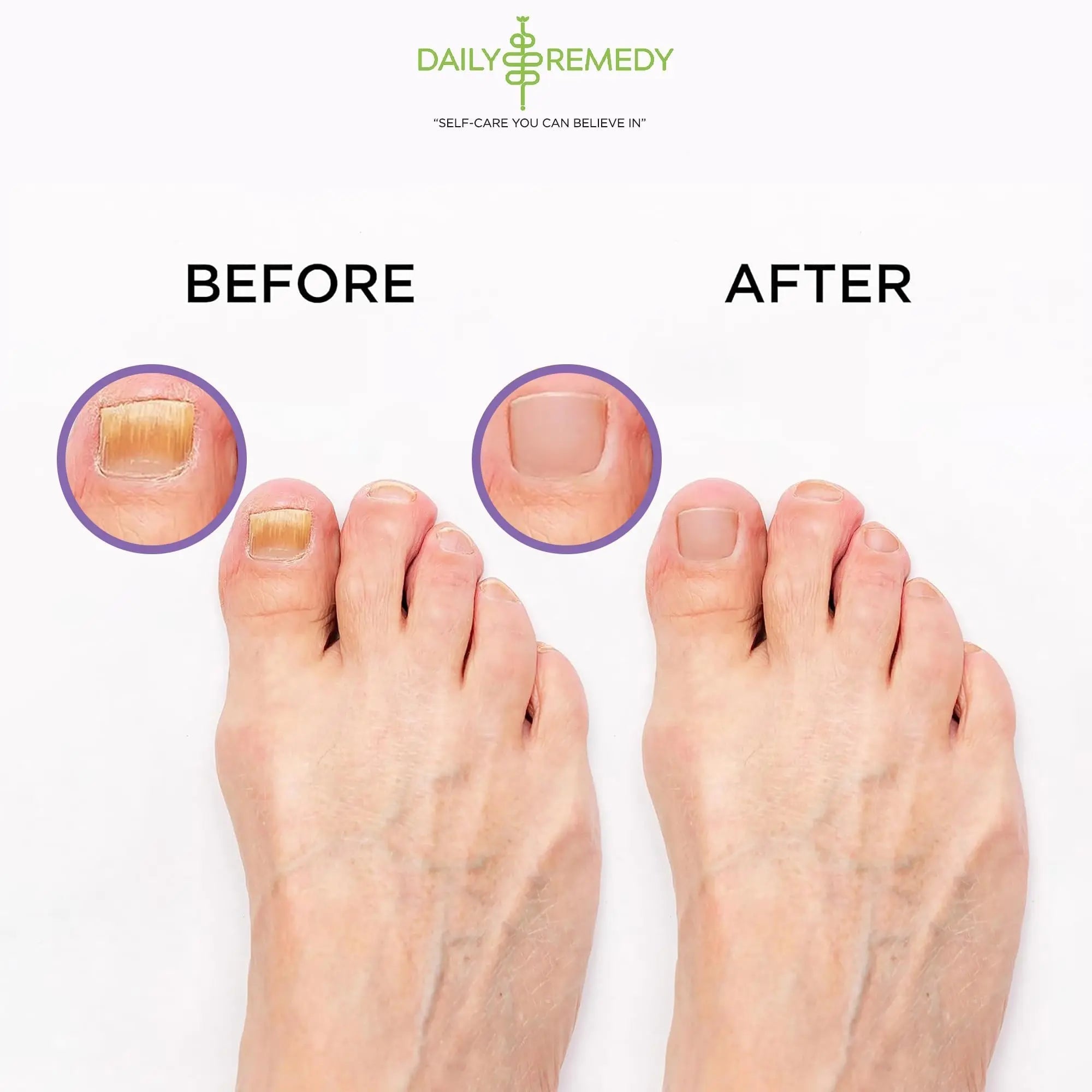 Calming Lavender Foot Soak with Epsom Salt, Made in USA, Foot Soak Soothes Sore Tired - TrustMedUSA