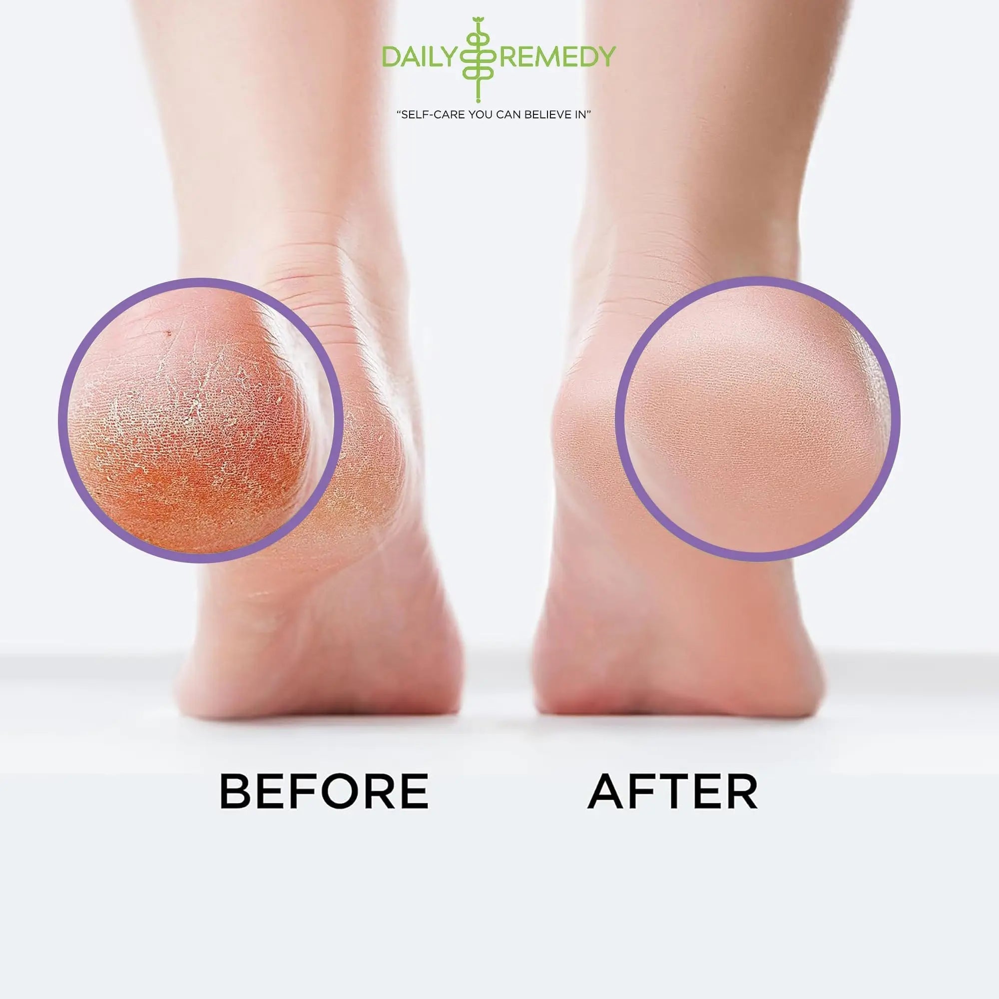 Calming Lavender Foot Soak with Epsom Salt, Made in USA, Foot Soak Soothes Sore Tired - TrustMedUSA