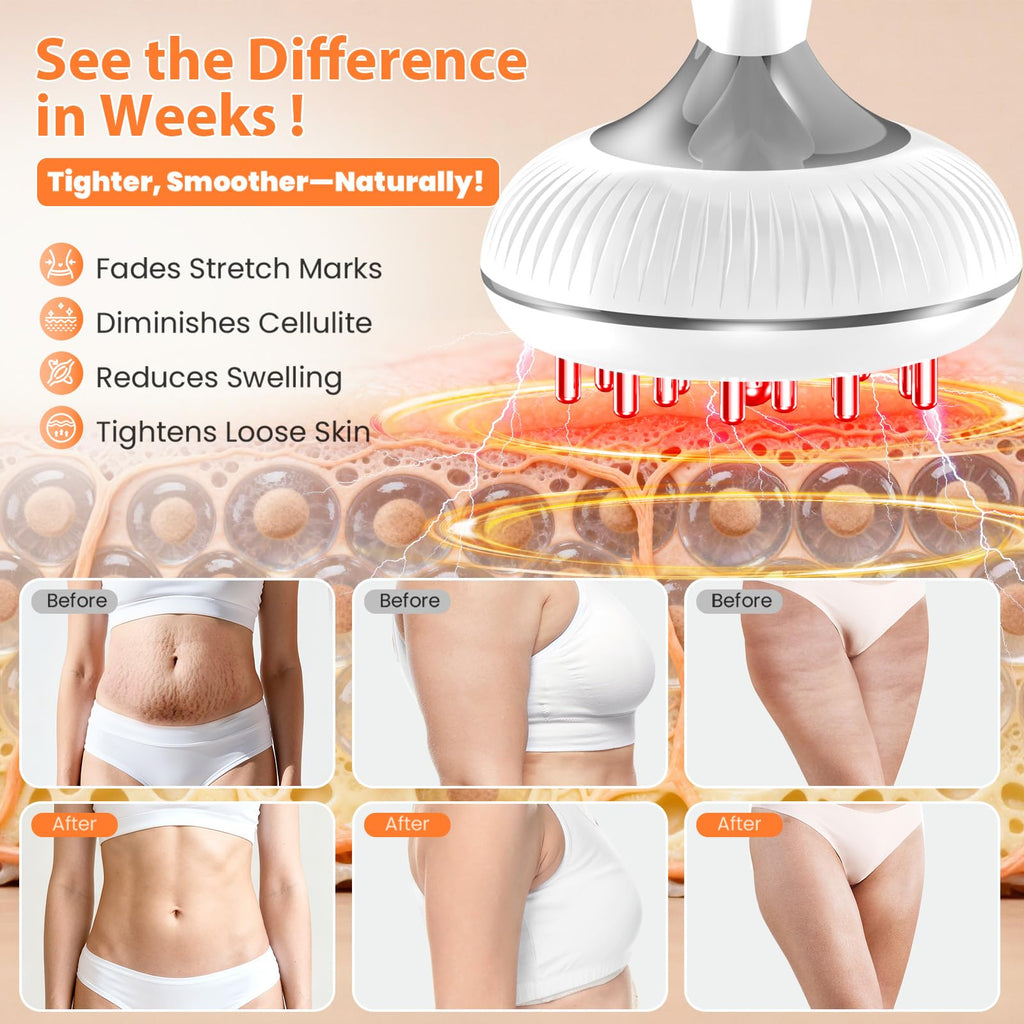 Choufaly Lymphatic Drainage Massager & Anti Cellulite Massage Tool, Helps Reduce Stretch Marks & Cellulite, for Legs, Arms & Belly, Body Sculpting Machine with Microcurrent & Light & Heat & Vibration - Maple Wellness Supplements