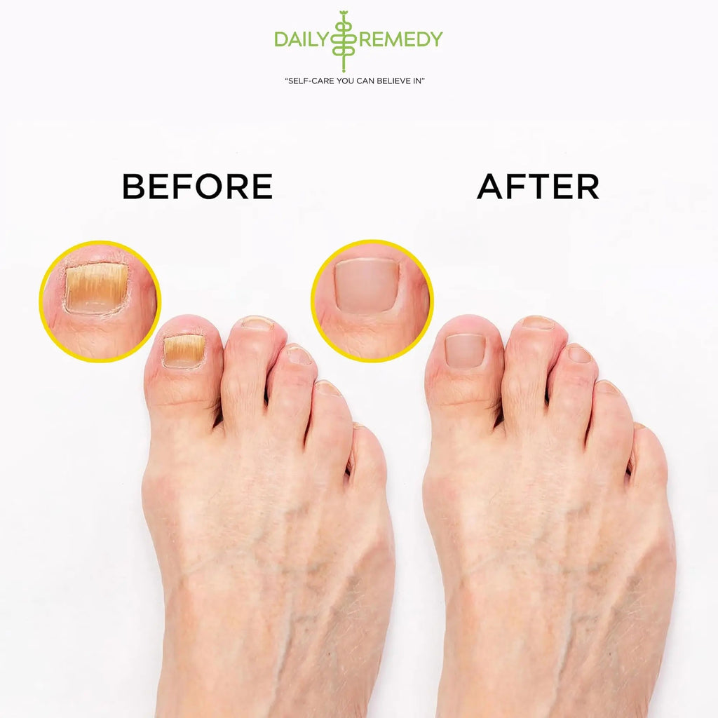 Citrus Detox Foot Soak with Epsom Salt - for Foot Callus, Immune Boost, Damaged Toenail - TrustMedUSA