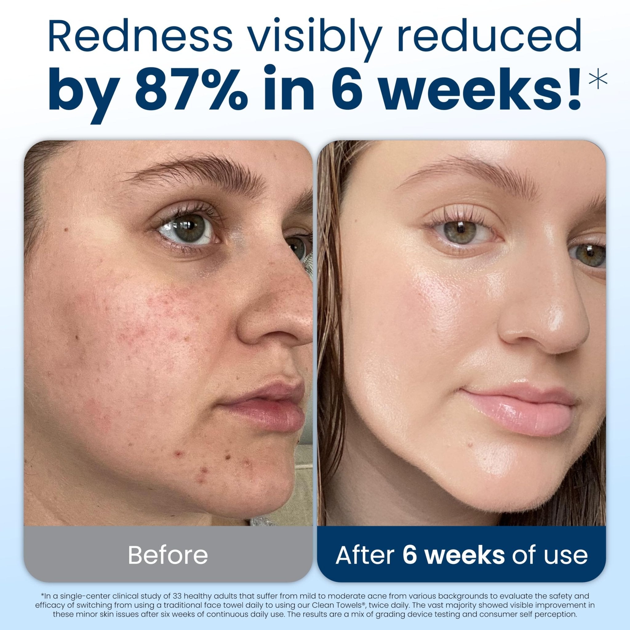 Clean Skin Club Clean Towels XL®, 100% USDA Biobased Face Towel, Disposable Face - TrustMedUSA