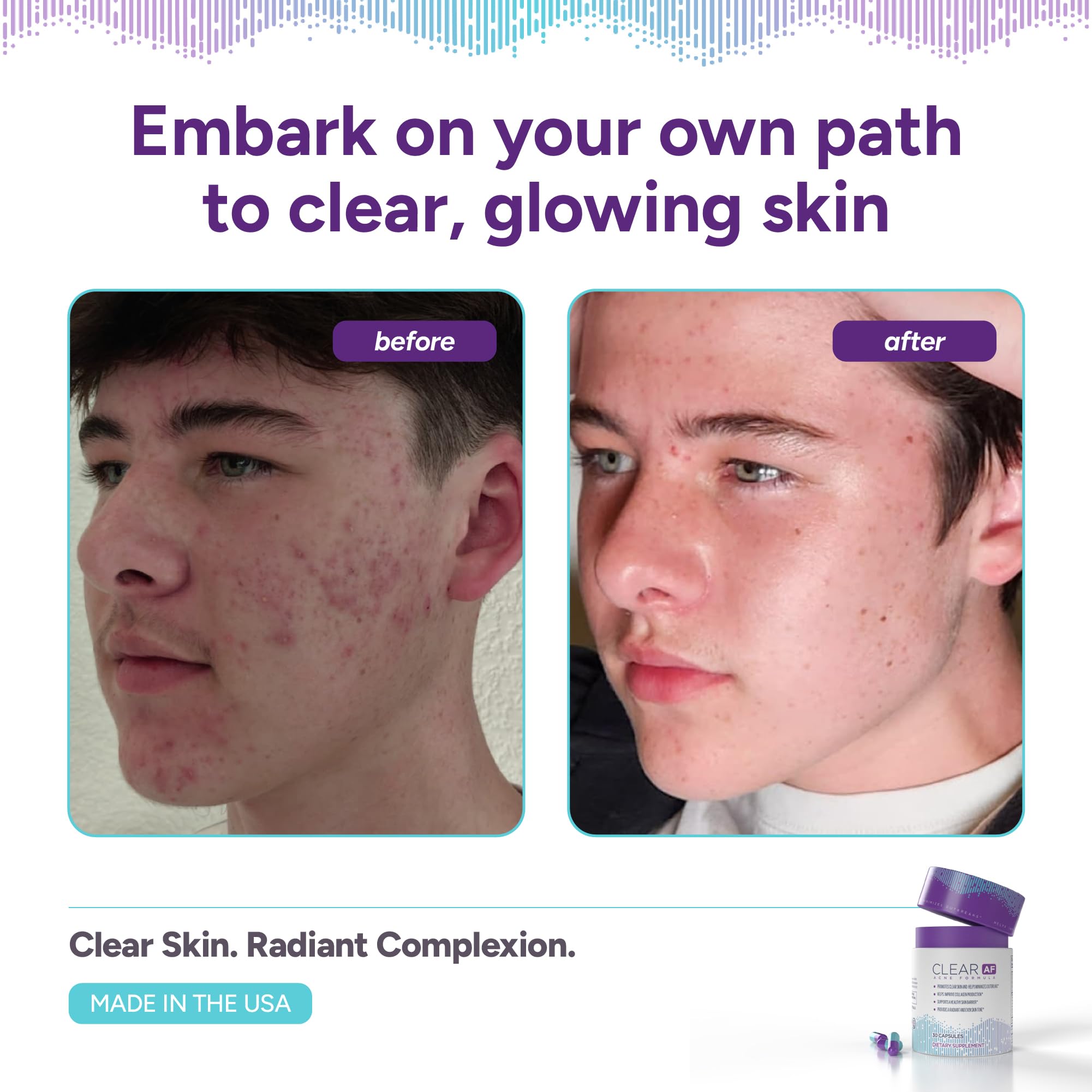 Clear AF Clear Skin Supplement | Skin Barrier Hydration & Clear Complexion Support with Vegan Ceramides, Zinc, Vitamin D3, B6, Riboflavin & Thiamine | Vegan Capsules | 30-Day Supply - TrustMedUSA