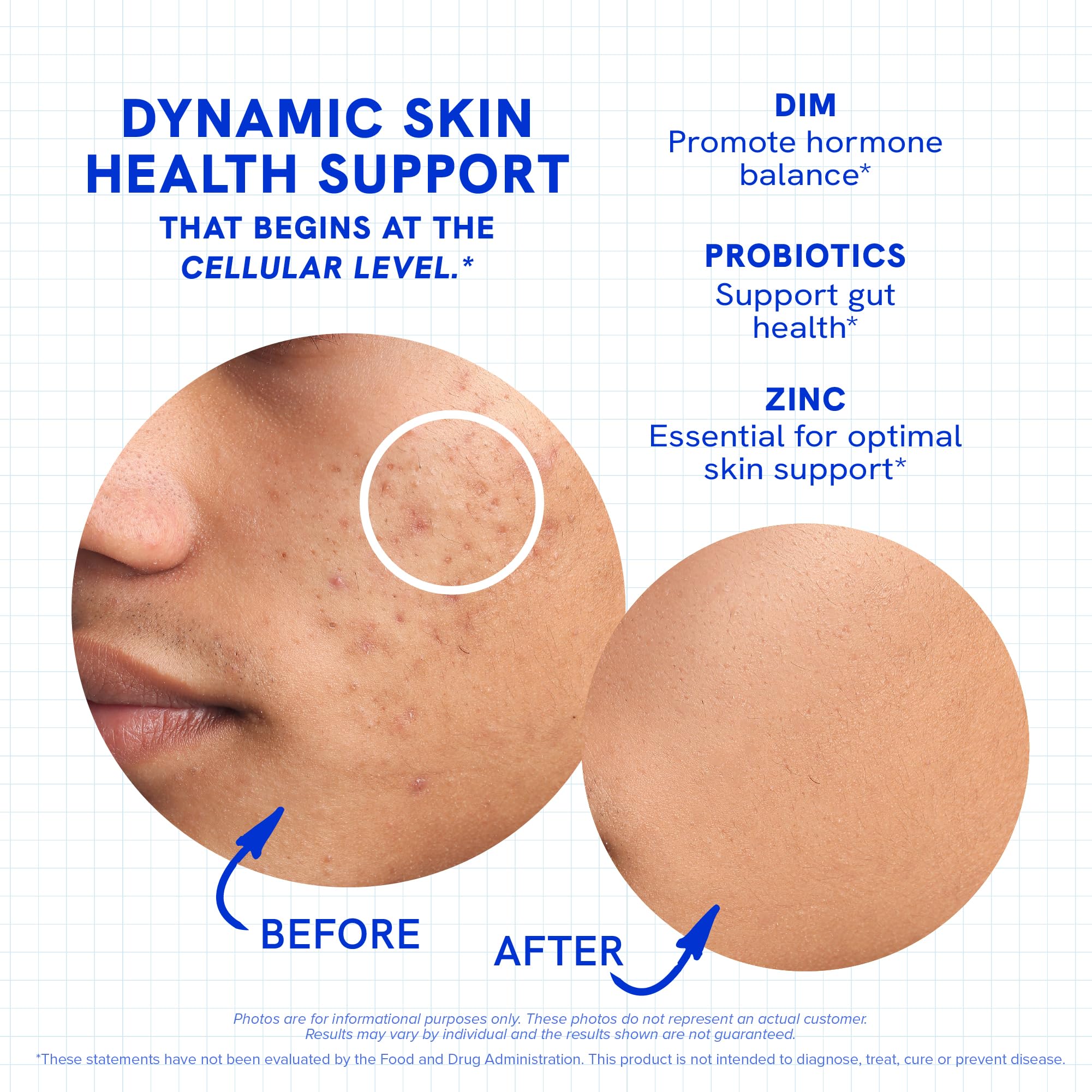 Clear Skin Supplement with Zinc, DIM & Probiotics | 3-in-1 Balance, Glow & Health Skin Support | Triple Action Hyaluronic Acid, Niaciminide & Vitamins for Hormone, Complexion & Gut Support | 180 Ct - TrustMedUSA